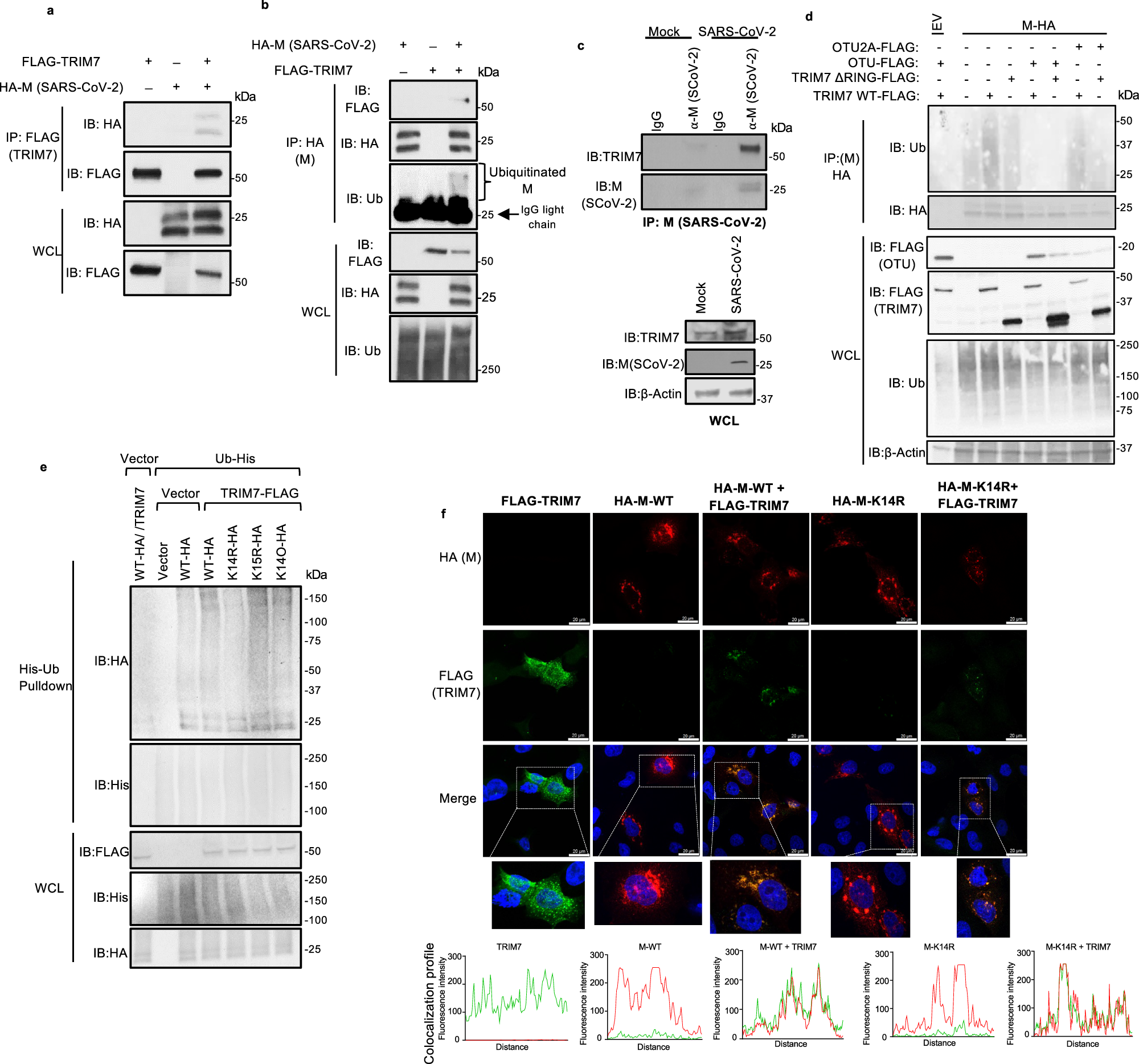 Fig. 1: TRIM7 ubiquitinates SARS-CoV-2 Membrane protein.
