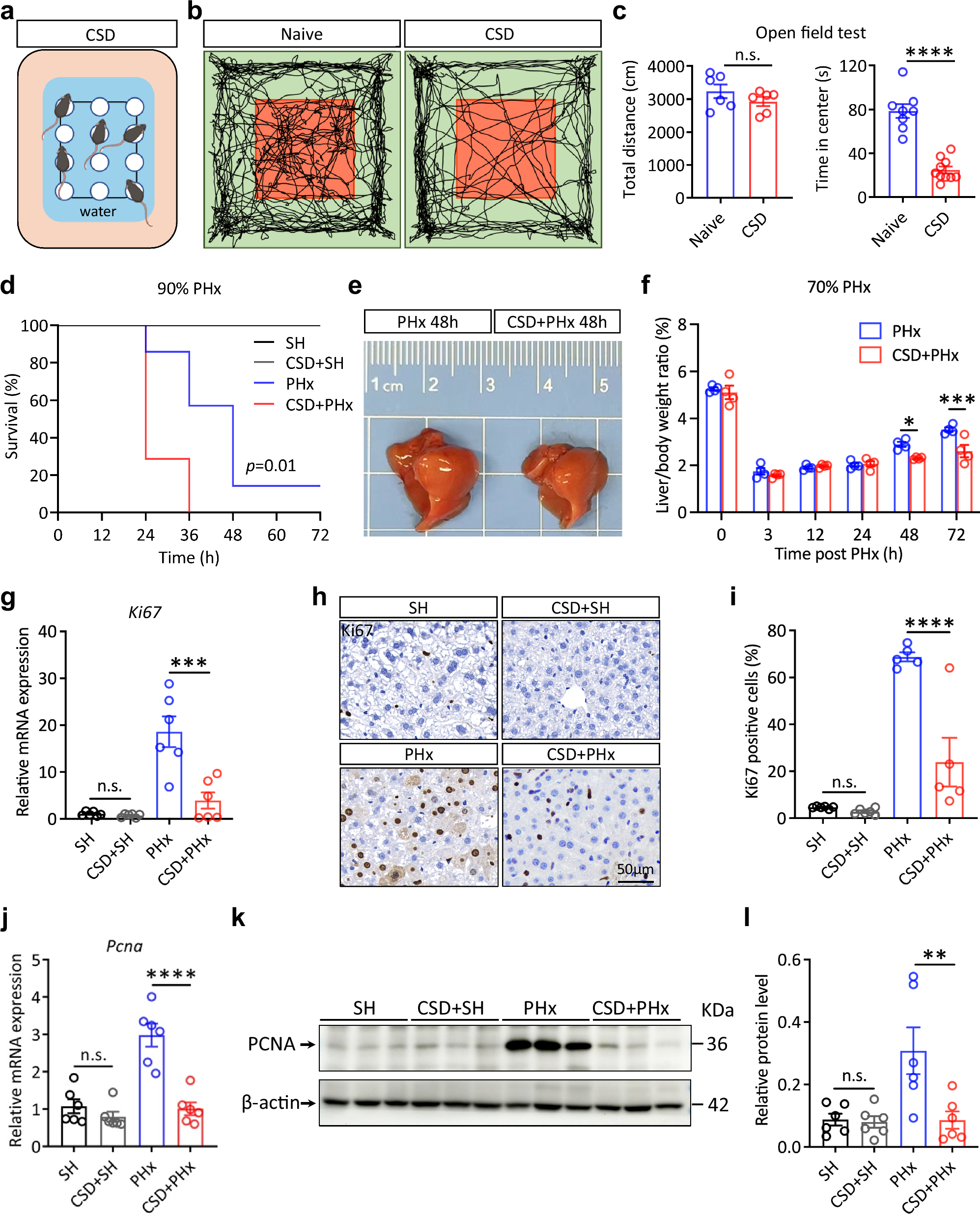 A brain-to-liver signal mediates the inhibition of liver regeneration under chronic stress in mice | Nature Communications a-brain-to-liver-signal-mediates-the-inhibition-of-liver-regeneration-under-chronic-stress-in-mice-nature-communications