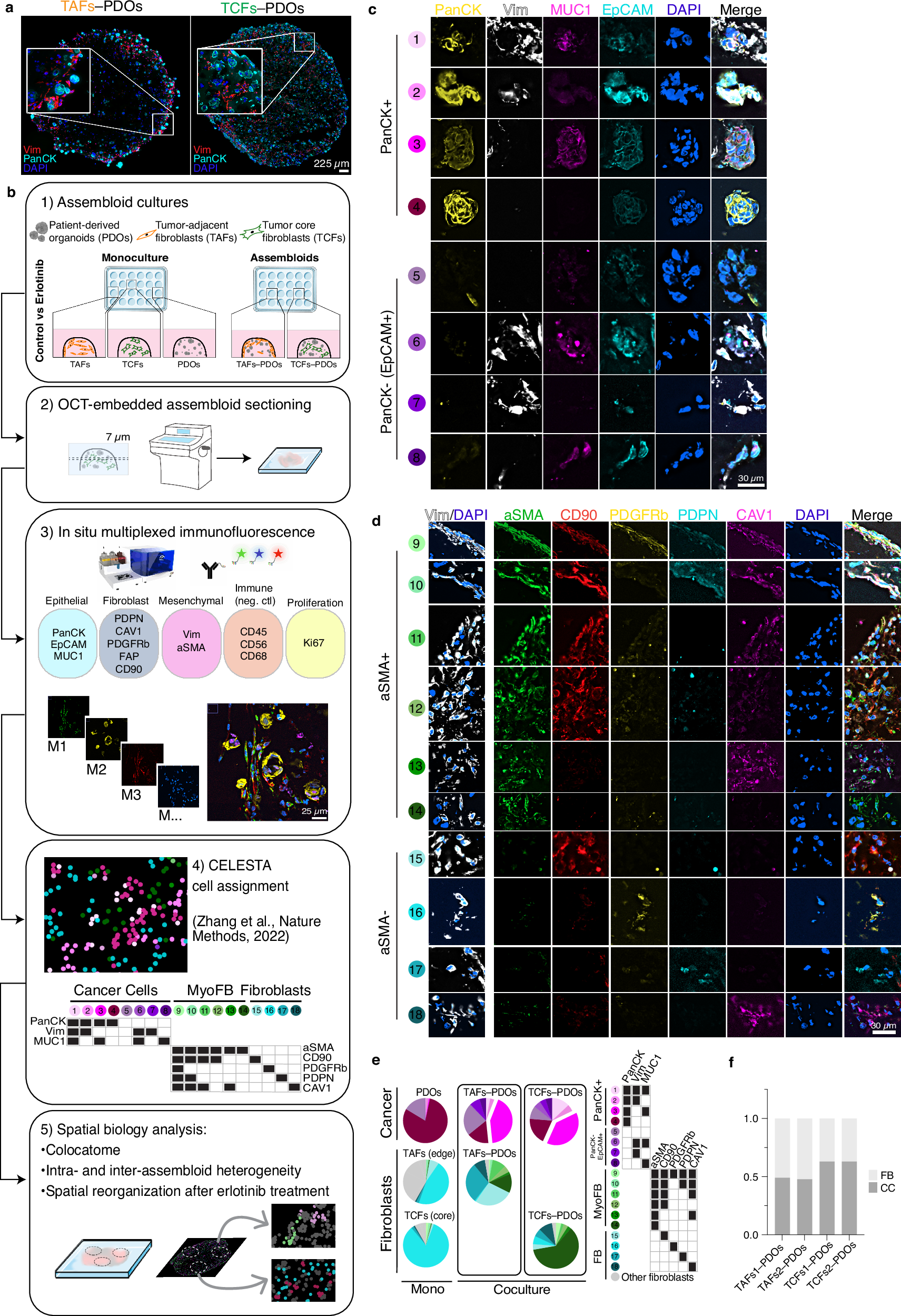 非がん細胞ががんに及ぼす影響を記録する方法を科学者らが開発(Scientists create way to document non-cancerous cells’ influence on cancer)