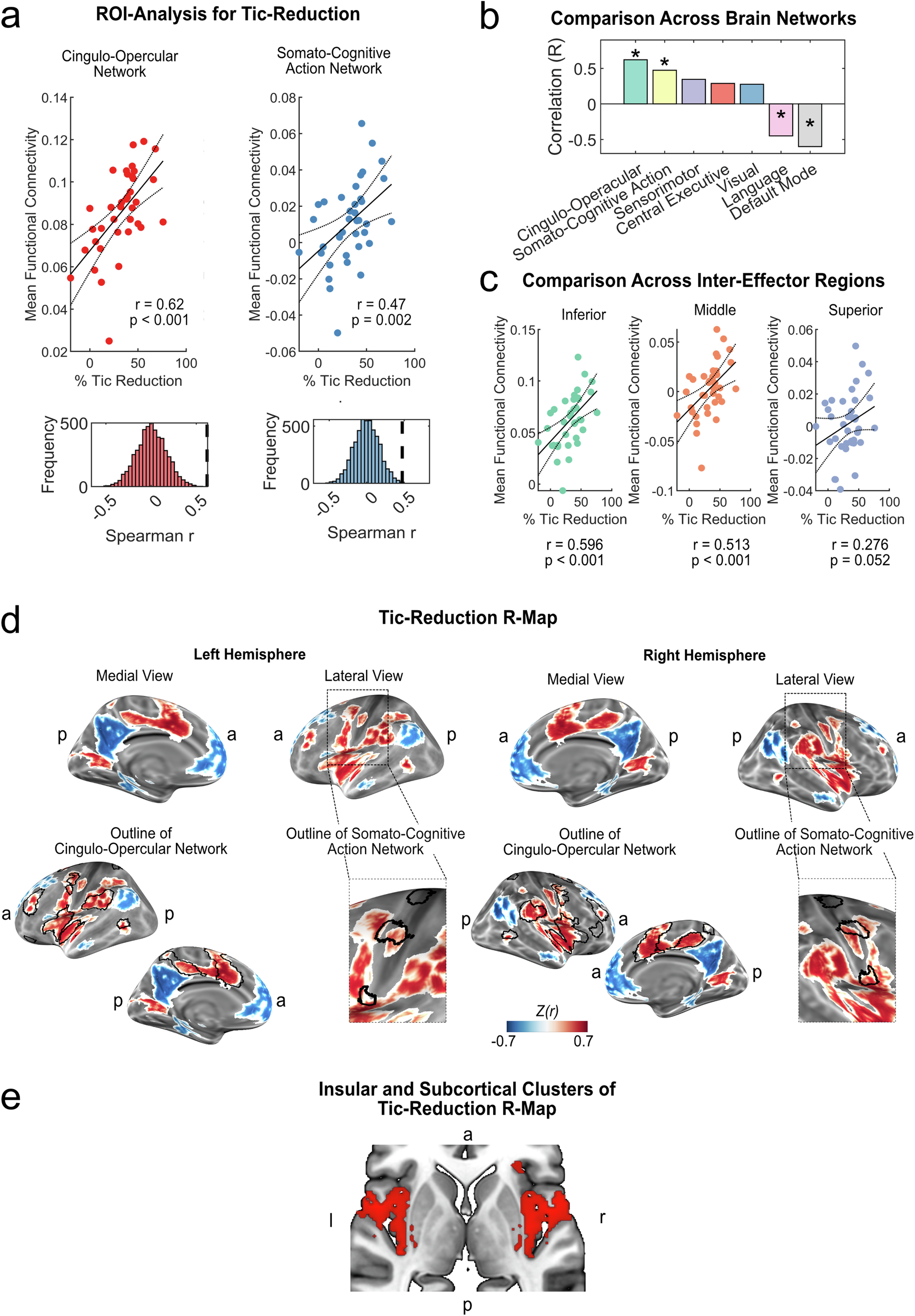 Fig. 3: Association of DBS connectivity and tic reduction.