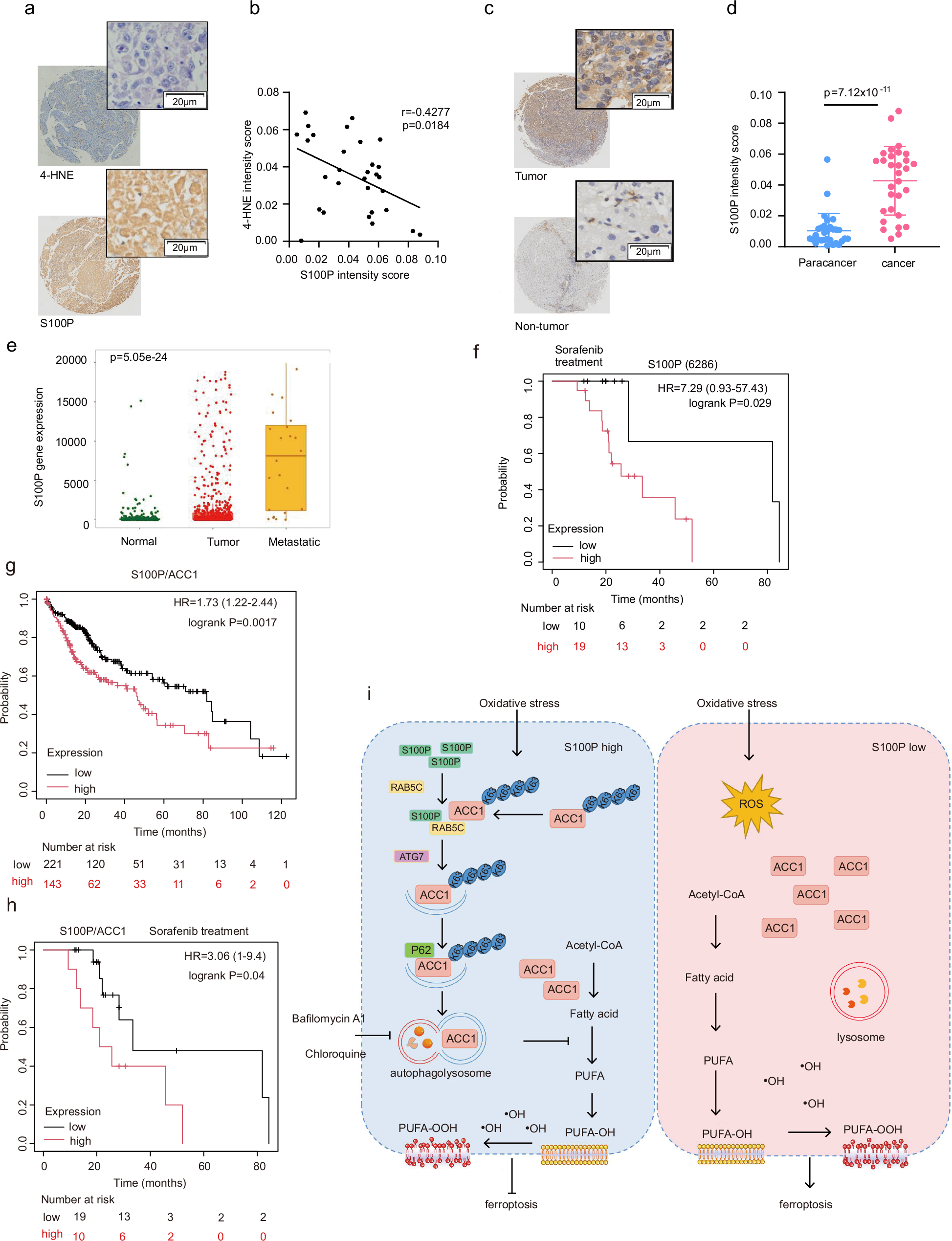 Fig. 8: S100P mediates ferroptosis in HCC patients.