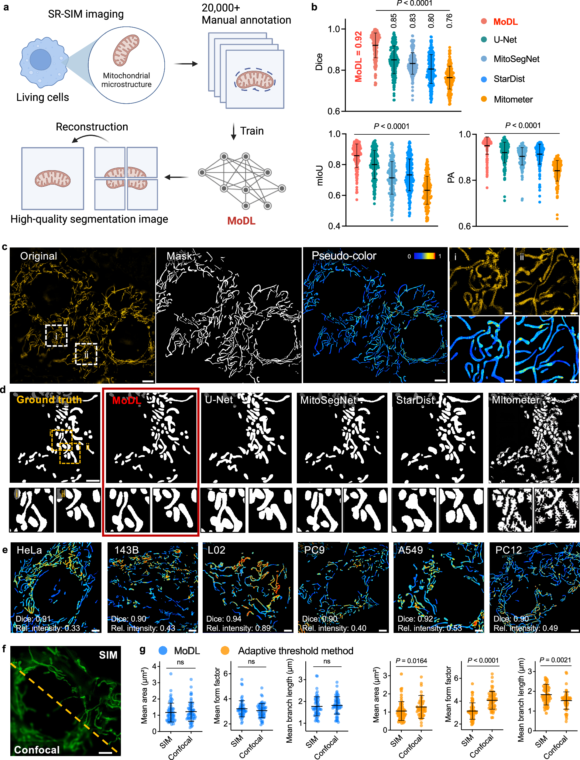 Fig. 2: MoDL’s first key pipeline: high-quality and accurate segmentation of mitochondrial fluorescence images.