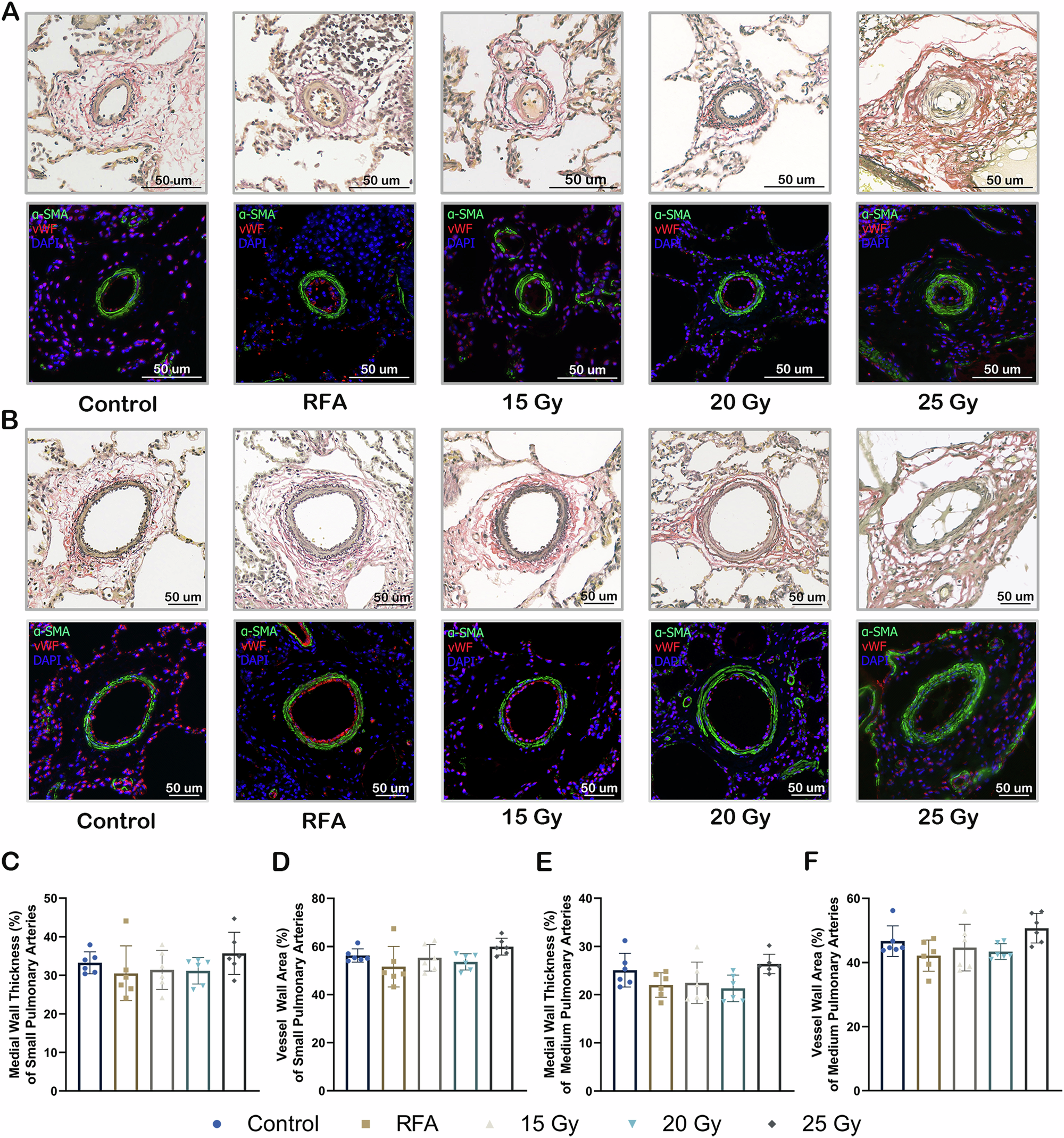 Fig. 6: Effects of Stereotactic Radioablative PADN on PA Remodeling.