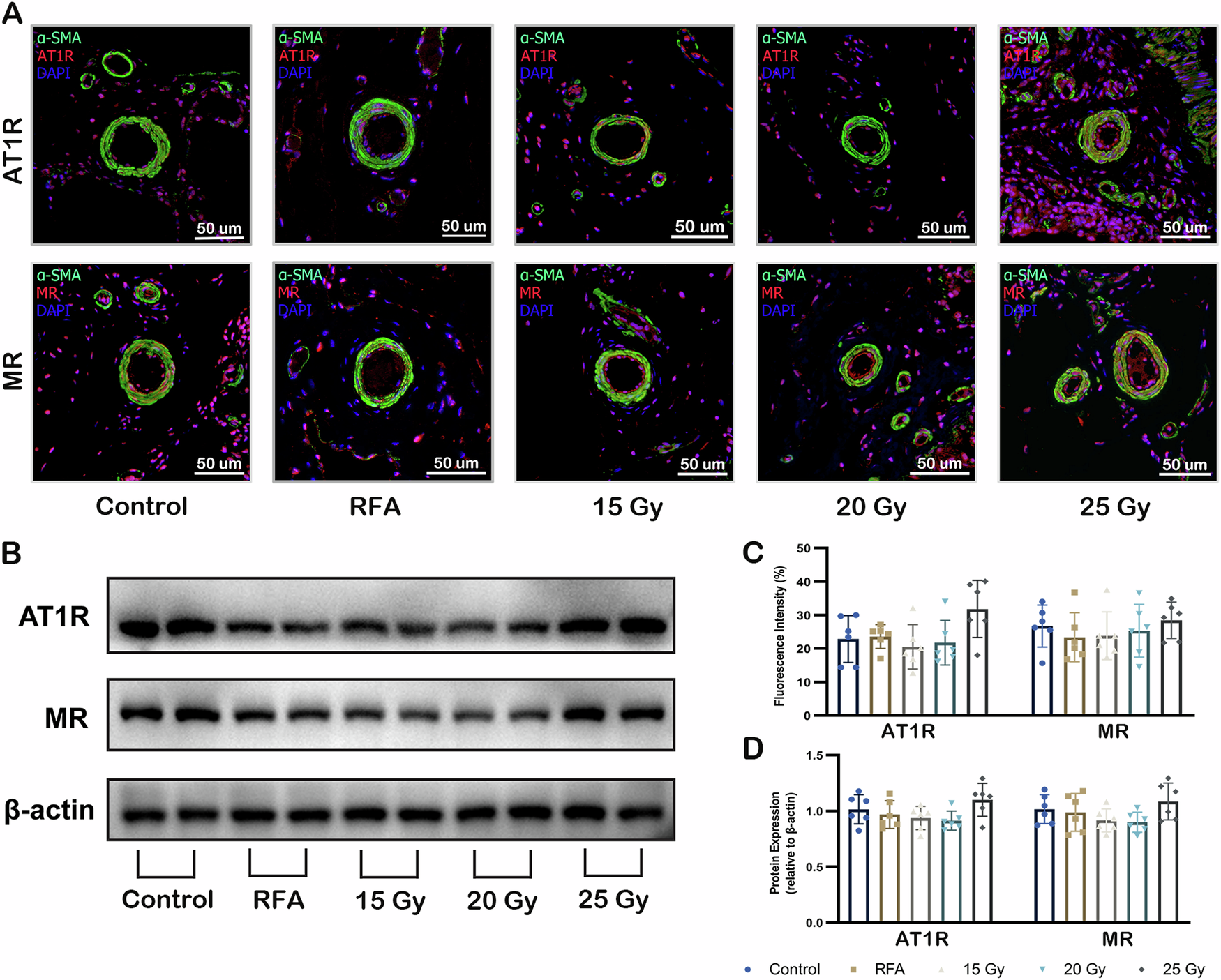 Fig. 7: Effects of stereotactic radioablative PADN on RAAS activity of lung tissue.