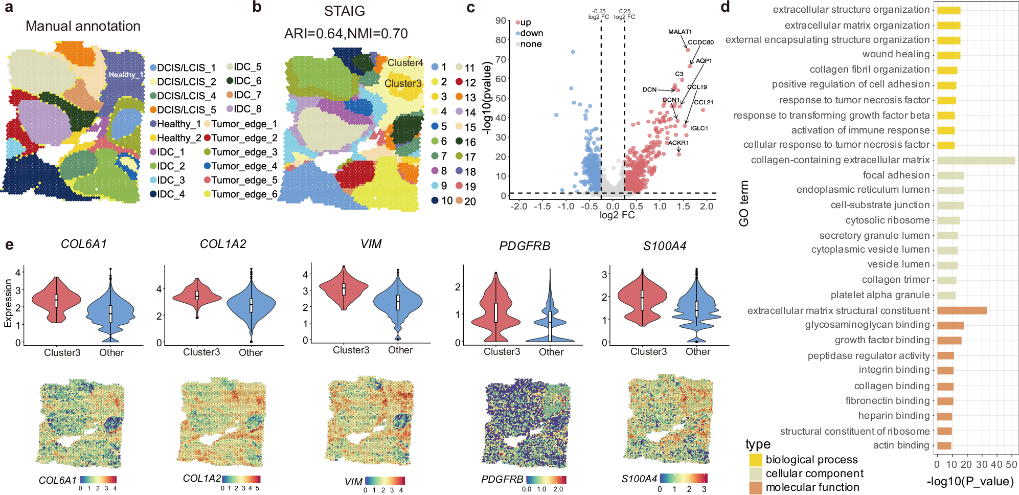 Fig. 6: Advanced spatial analysis by STAIG reveals cancer-associated fibroblasts (CAF)-rich clusters in human Breast Cancer ST Data.