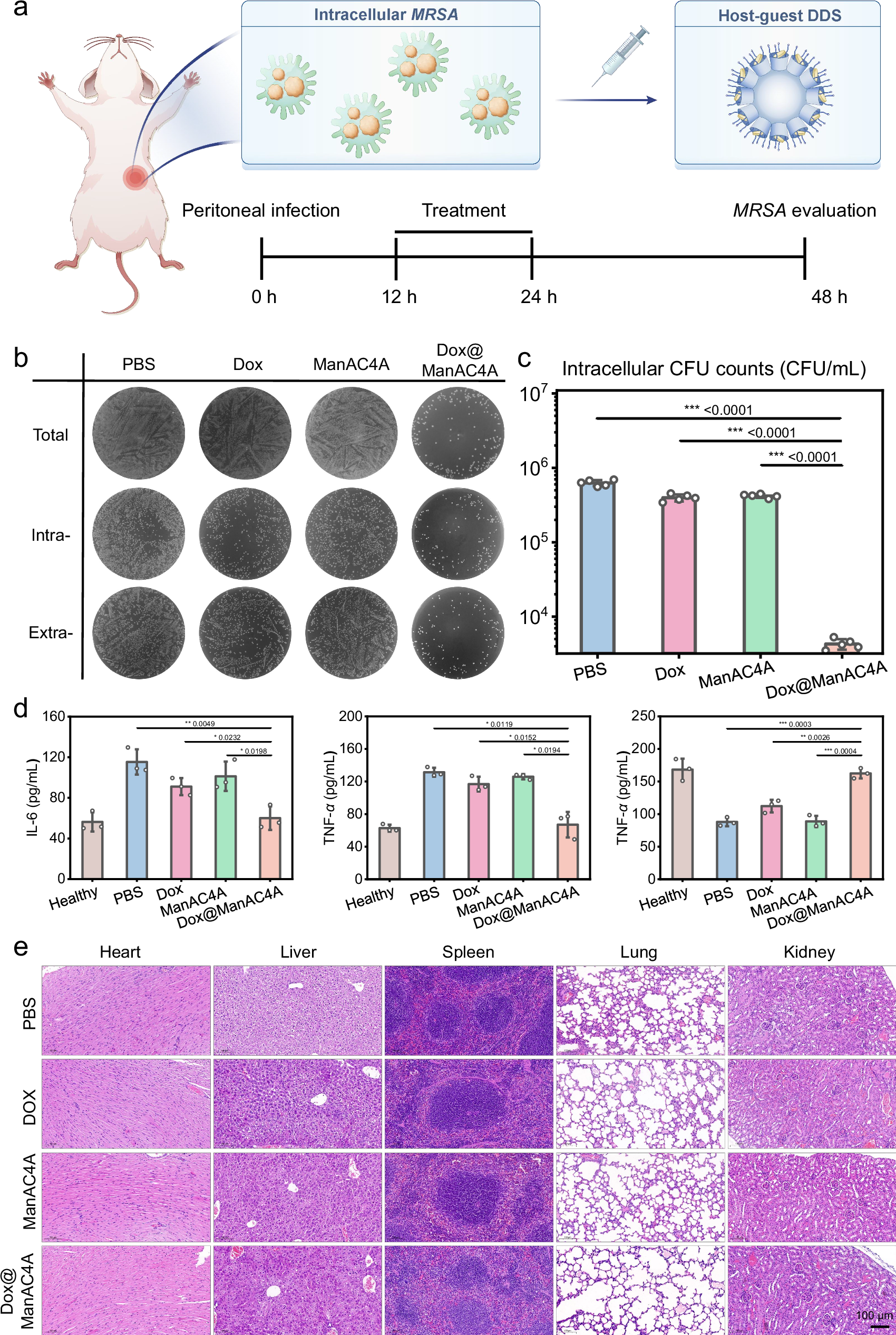 Fig. 6: The ability of Dox@ManAC4A to treat MRSA-infected peritonitis in vivo.
