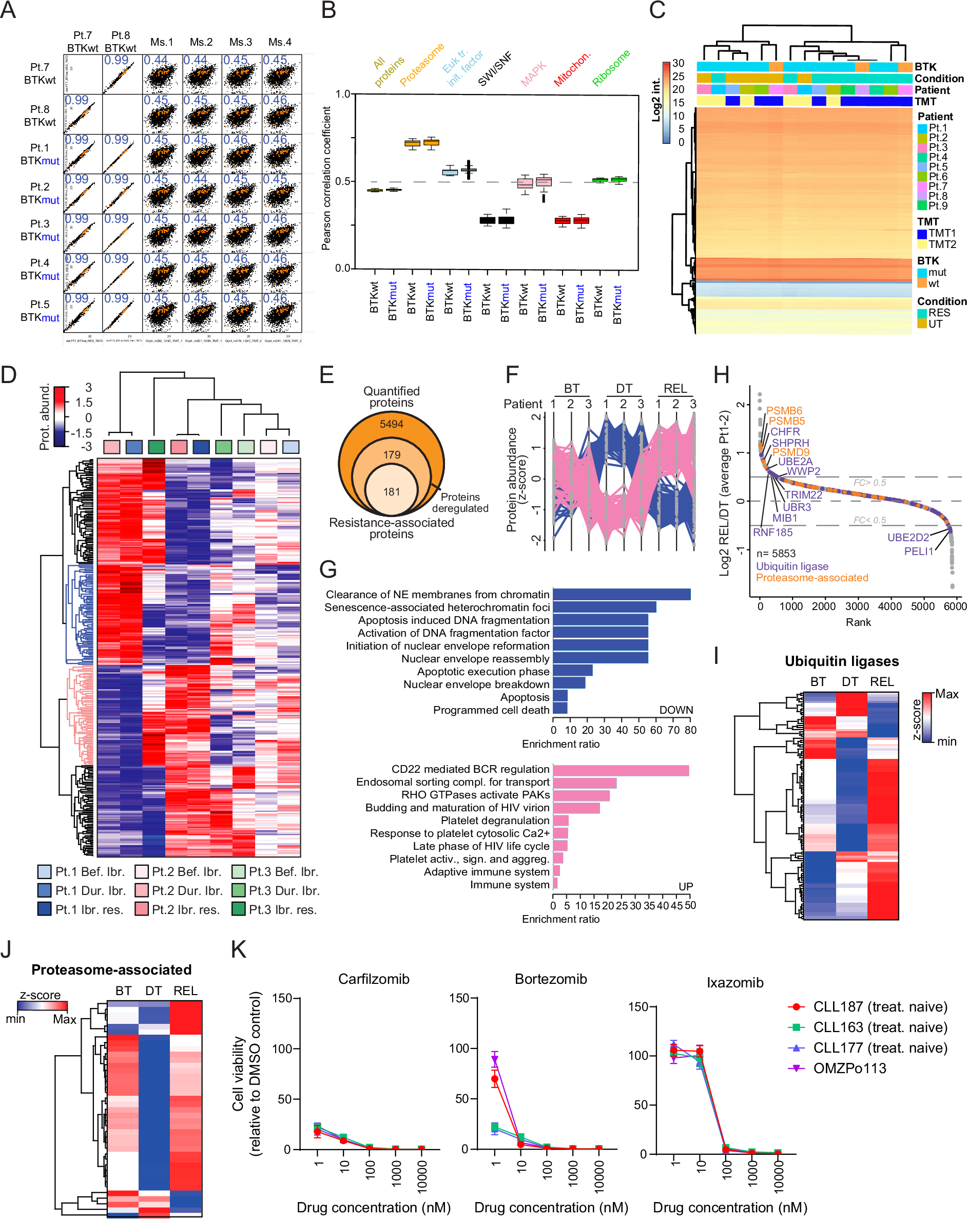 Fig. 7: Commonly deregulated trends in ibrutinib-resistant CLL patients revealed by proteome analysis.
