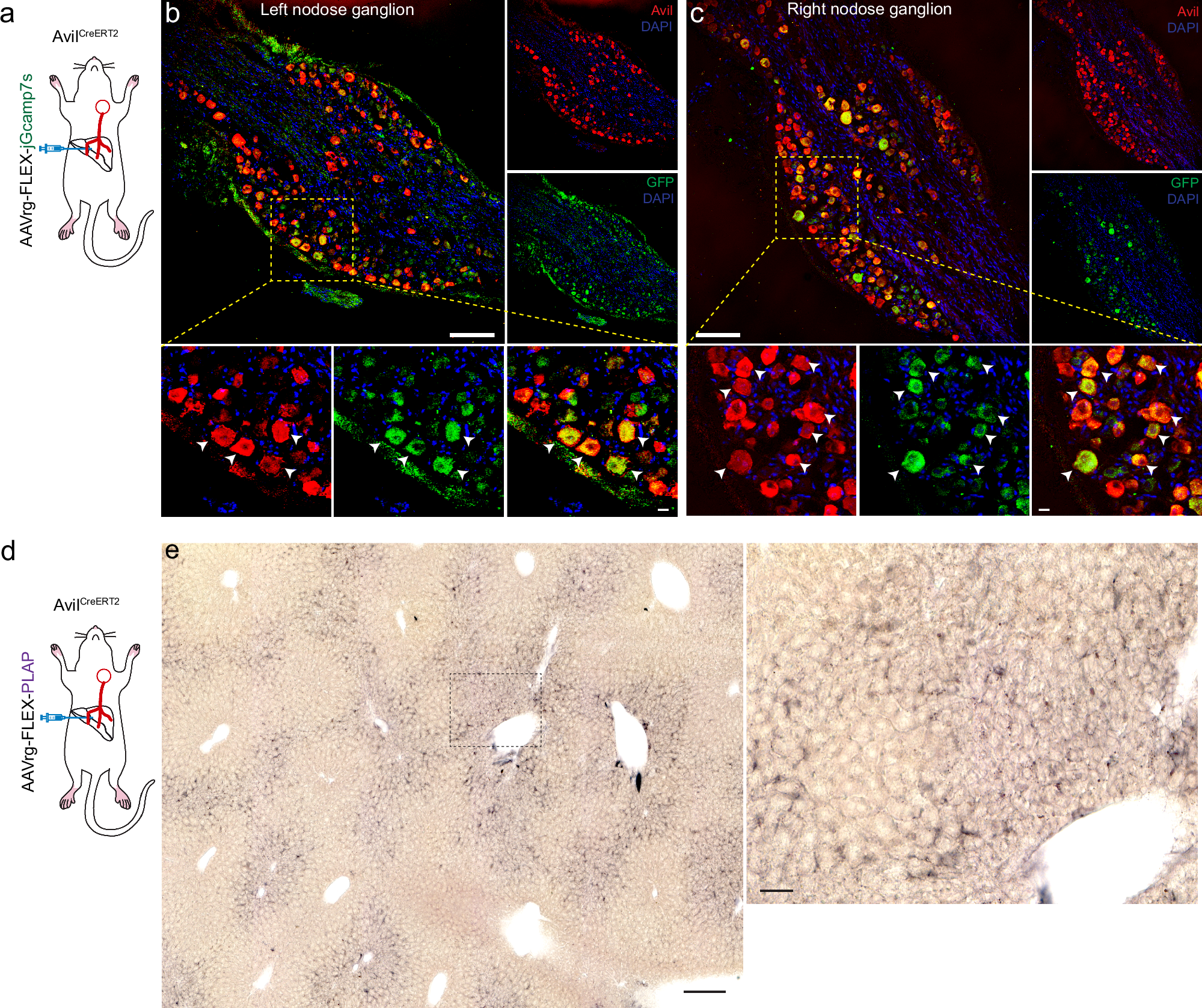 Fig. 2: Immunohistochemical identification of vagal sensory neurons innervating the liver.