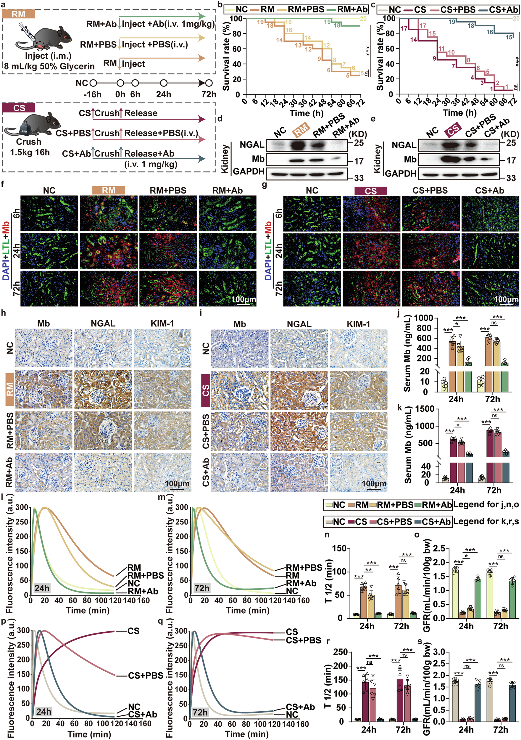 Fig. 2: Anti-Mb RabMAb alleviates kidney injury of RM/CS-AKI mice by decreasing Mb accumulation.