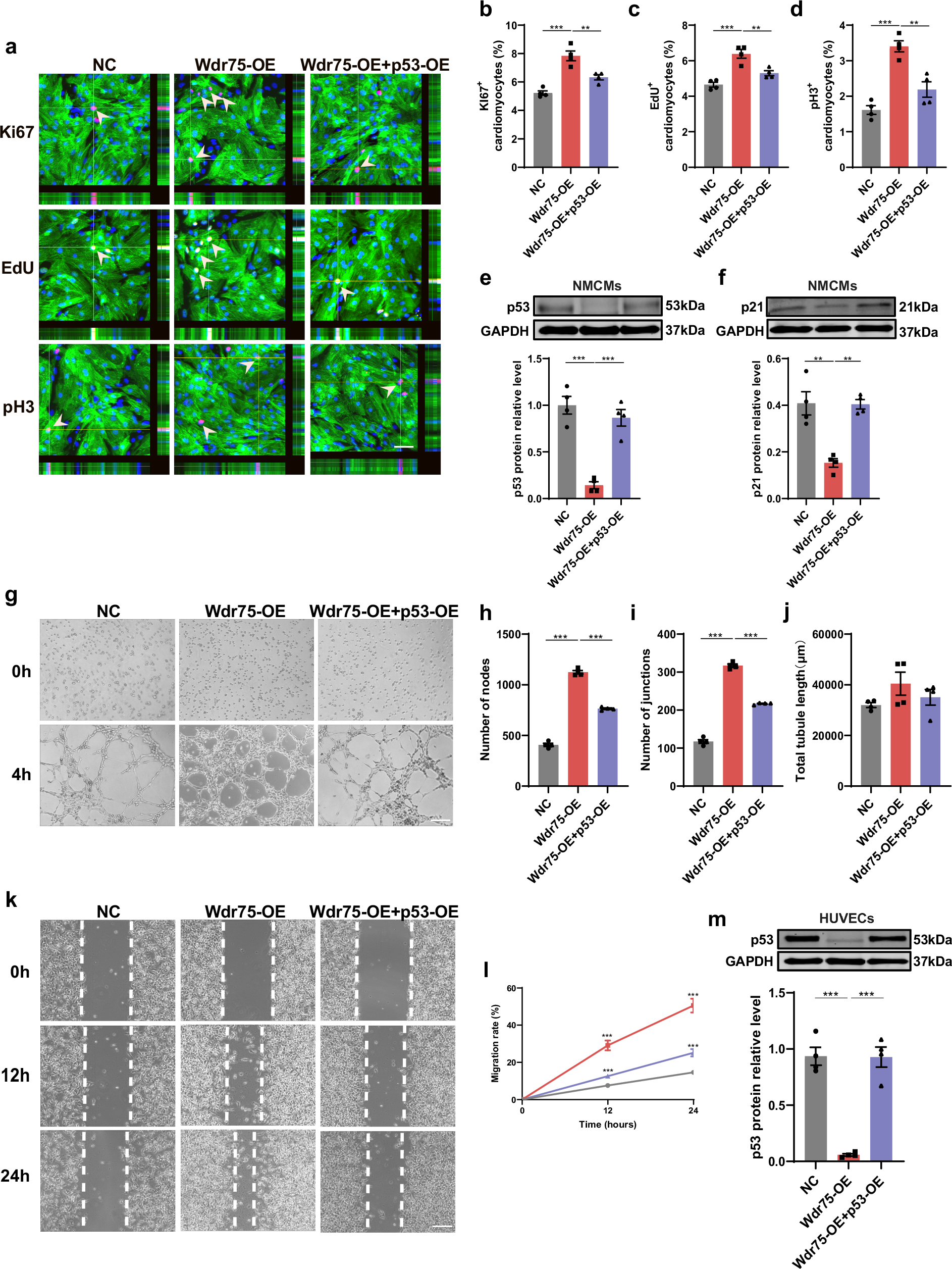 Fig. 8: The effects of Wdr75 on cardiomyocyte proliferation and angiogenesis.