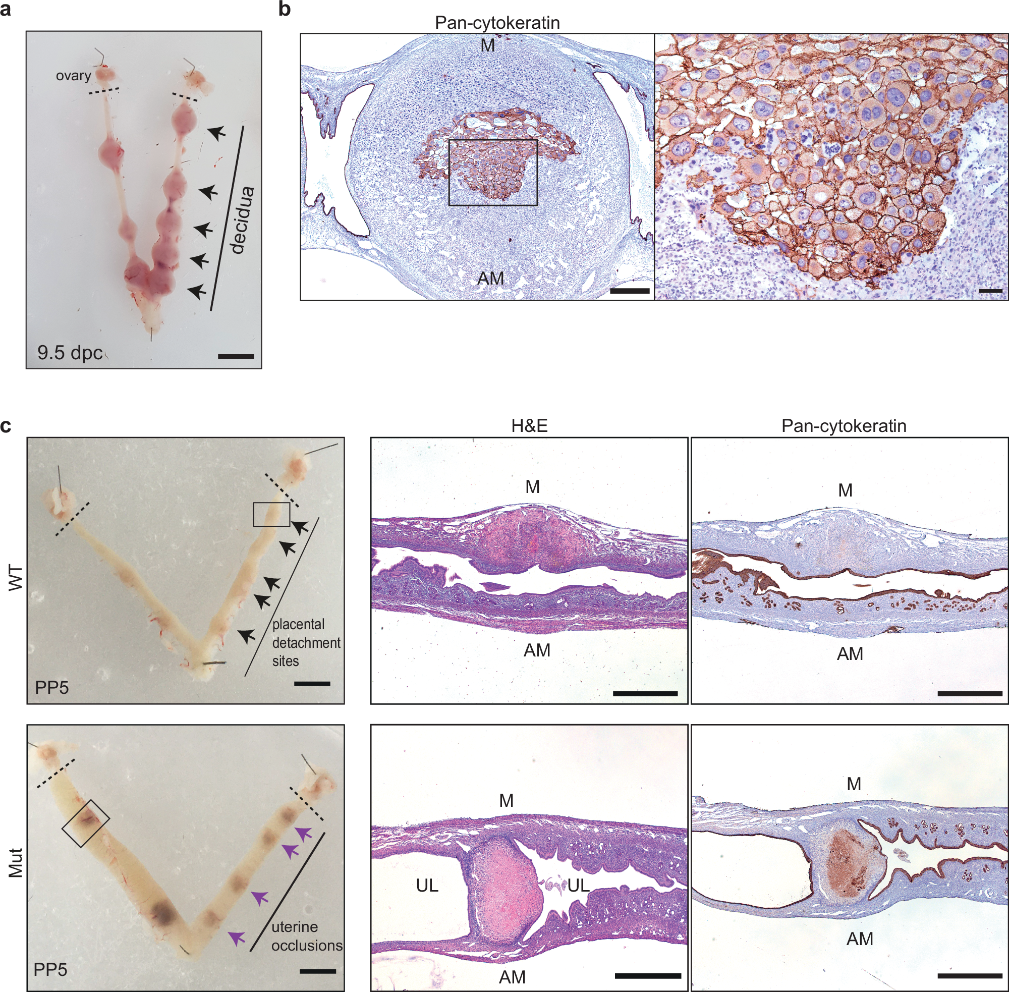 Fig. 1: Blimp1 mutants display impaired uterine remodelling at post-partum stages following embryo death.