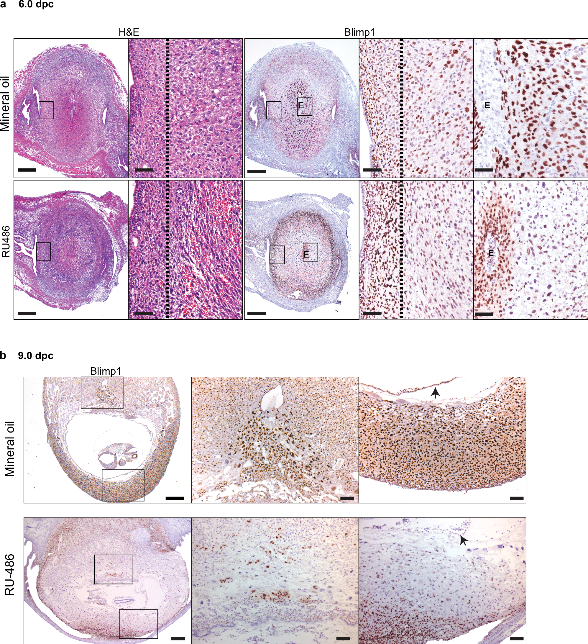 Fig. 2: Wild type decidua display dramatic changes in the pattern of Blimp1 expression 14 hours post RU486 treatment.