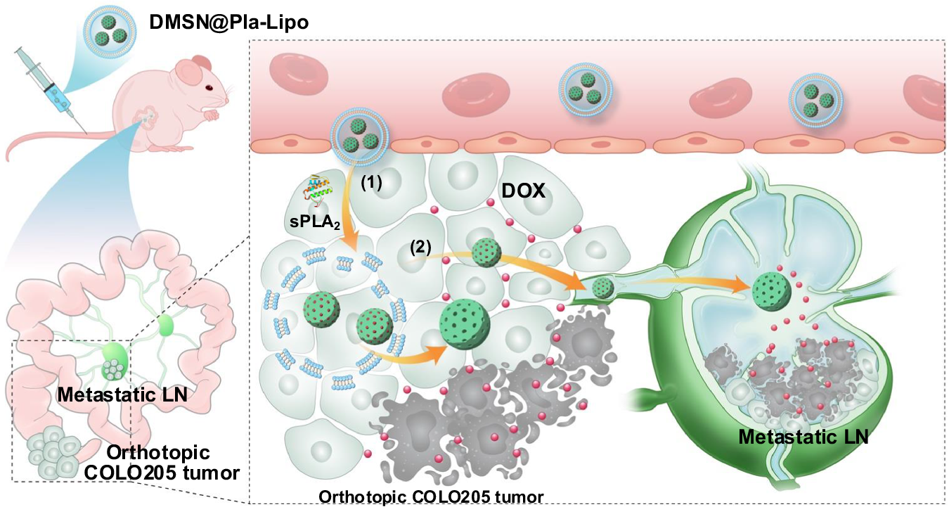 A multistage drug delivery approach for colorectal primary tumors and lymph  node metastases | Nature Communications
