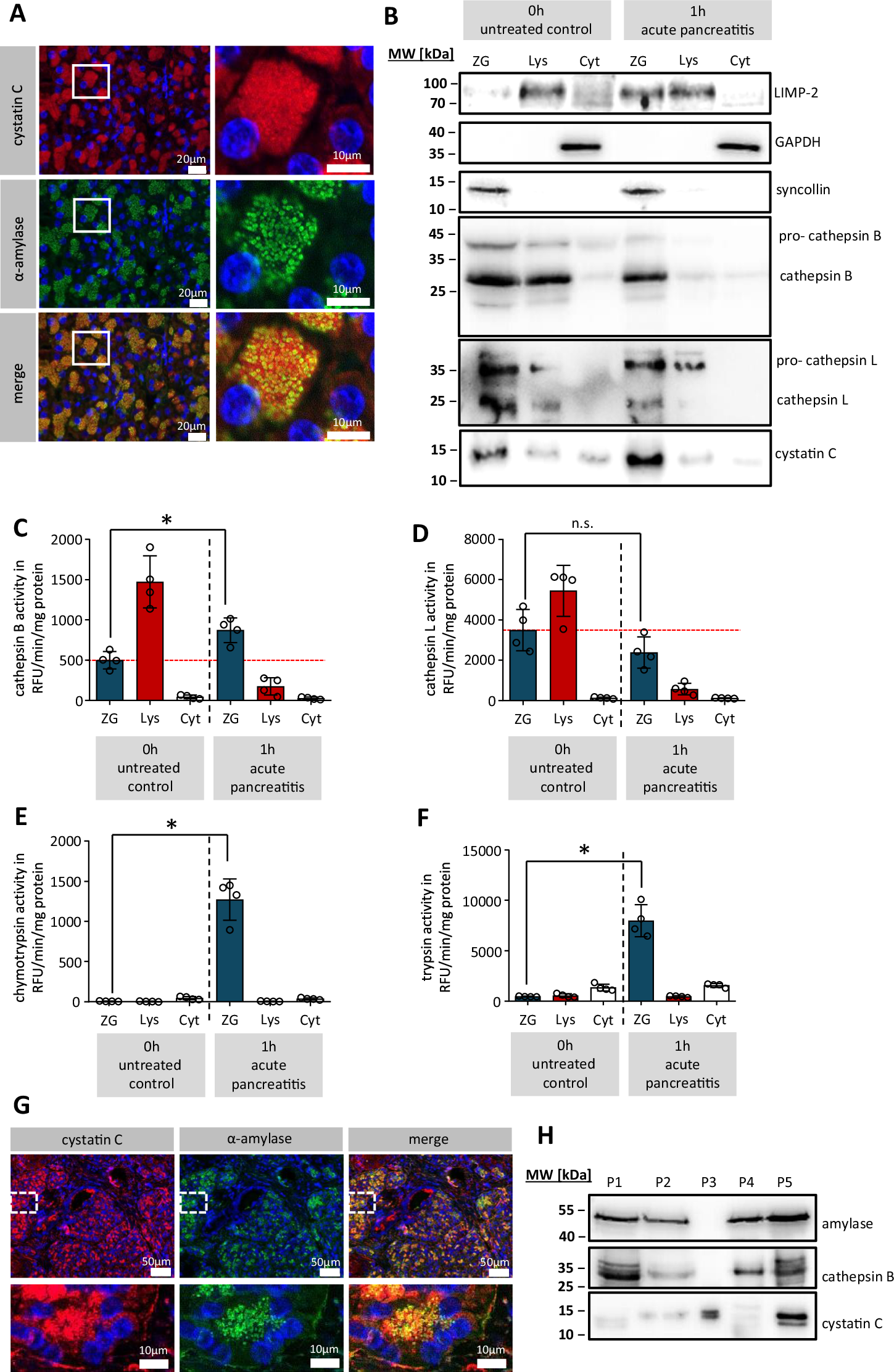 Fig. 1: Cystatin C expression in the secretory compartment of pancreatic acinar cells.