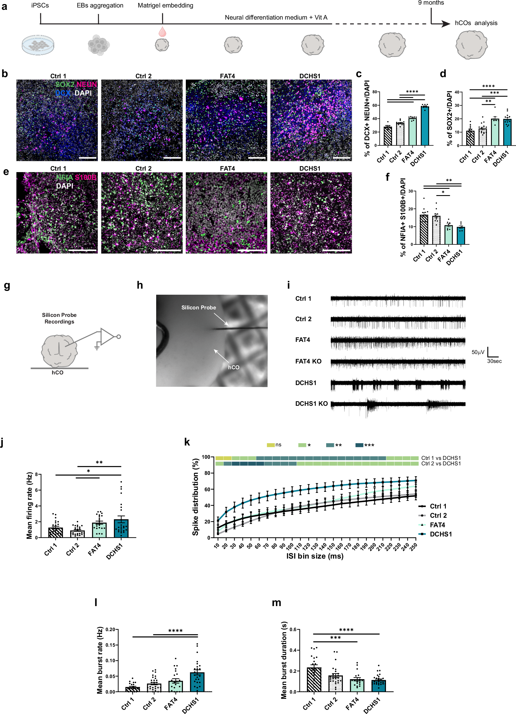 誤配置されたニューロンが脳の配線を混乱させる (Misplaced neurons disrupt wiring of the brain)