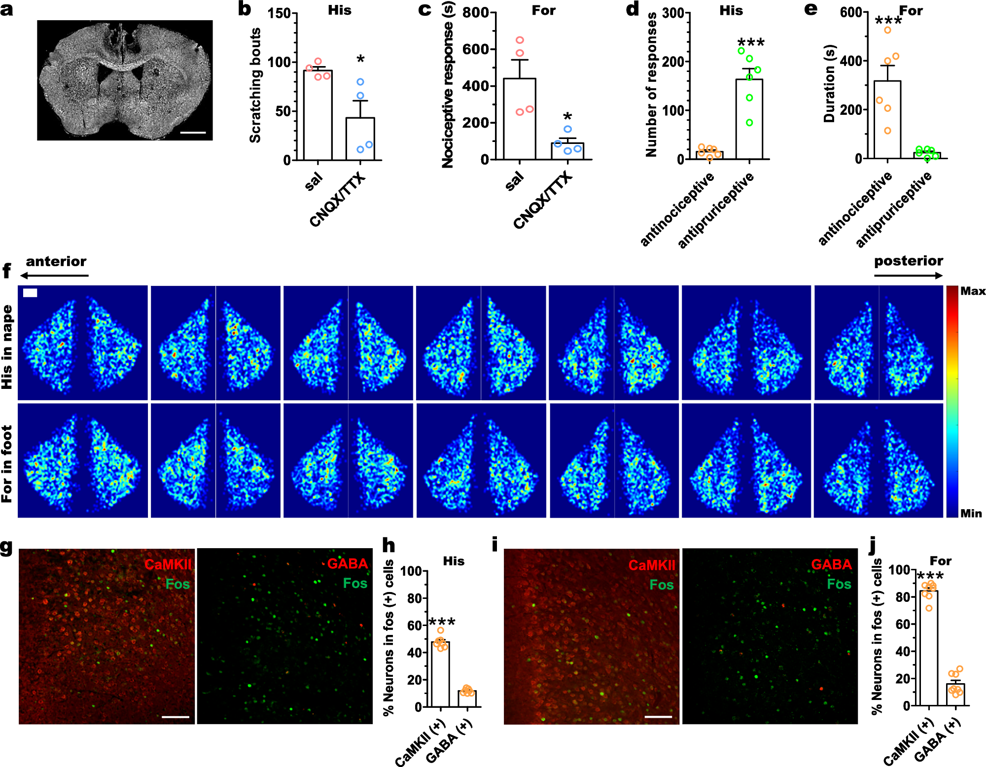 脳が痛みと痒みを区別する仕組みを解明(How the Brain Distinguishes Between Pain and Itch)