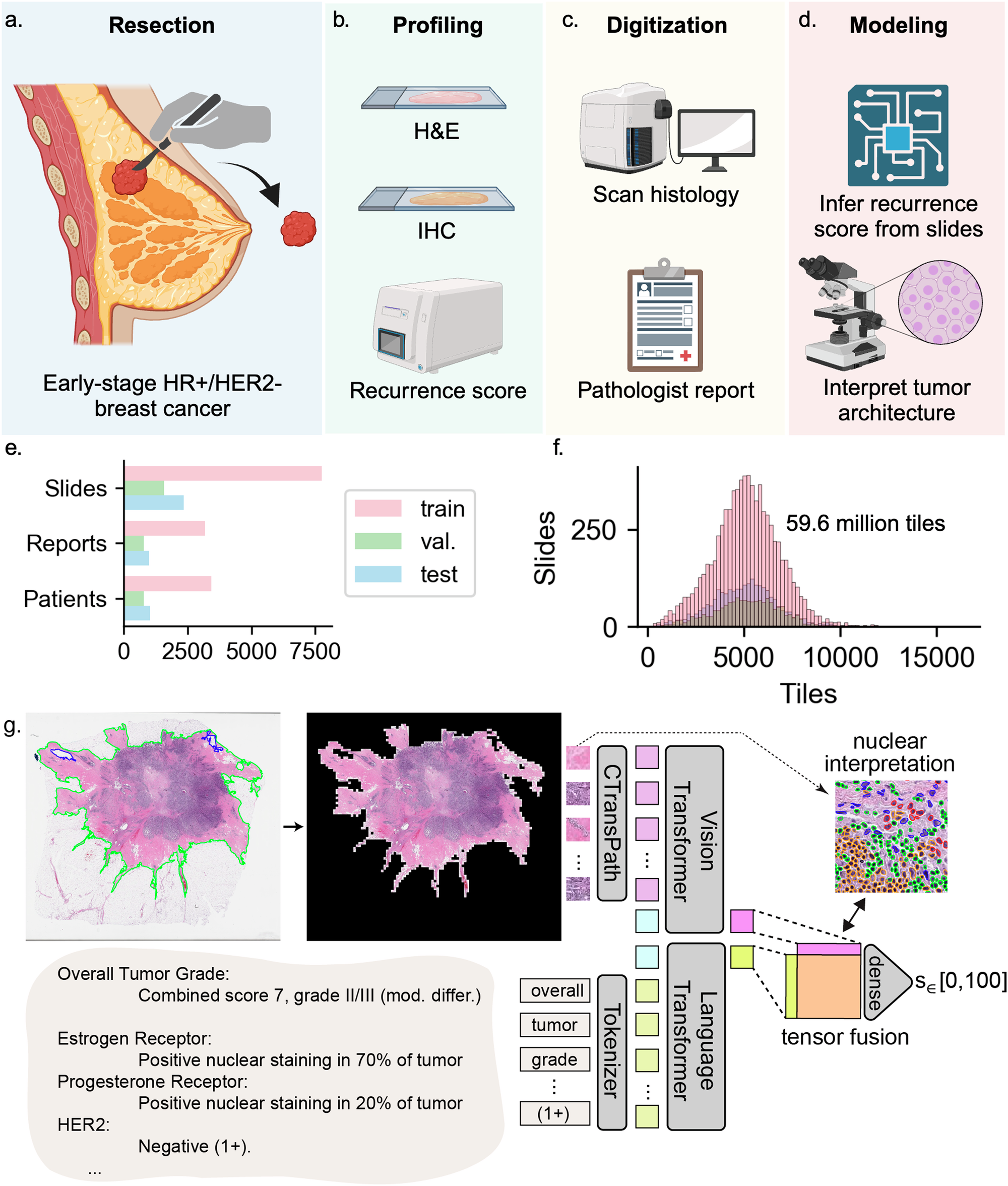 Fig. 1: Developing a multimodal transformer model for breast cancer risk.
