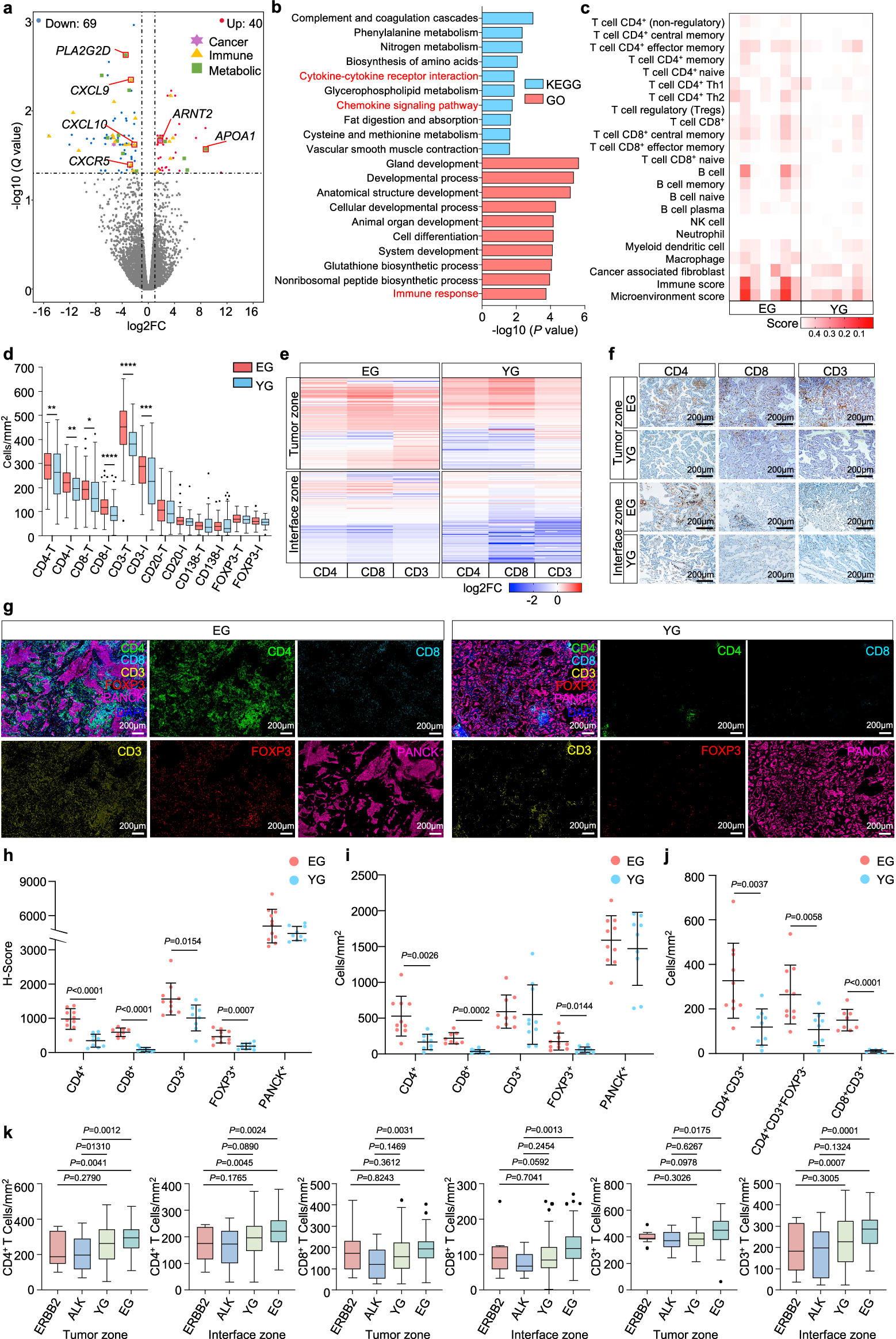 Fig. 3: Transcriptomic and immunological analysis of NSCLC of younger and elder patients.