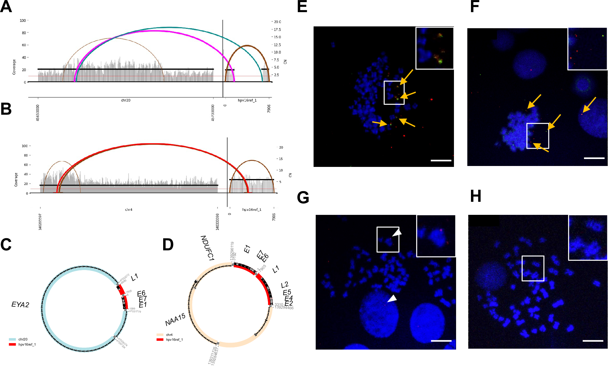 ヒトとHPVの遺伝子が腫瘍増殖を促進(Human and HPV Genes Combine to Form Extrachromosomal DNA That Promotes Oropharyngeal Tumor Growth) ヒトとHPVの遺伝子が腫瘍増殖を促進(Human and HPV Genes Combine to Form Extrachromosomal DNA That Promotes Oropharyngeal Tumor Growth)