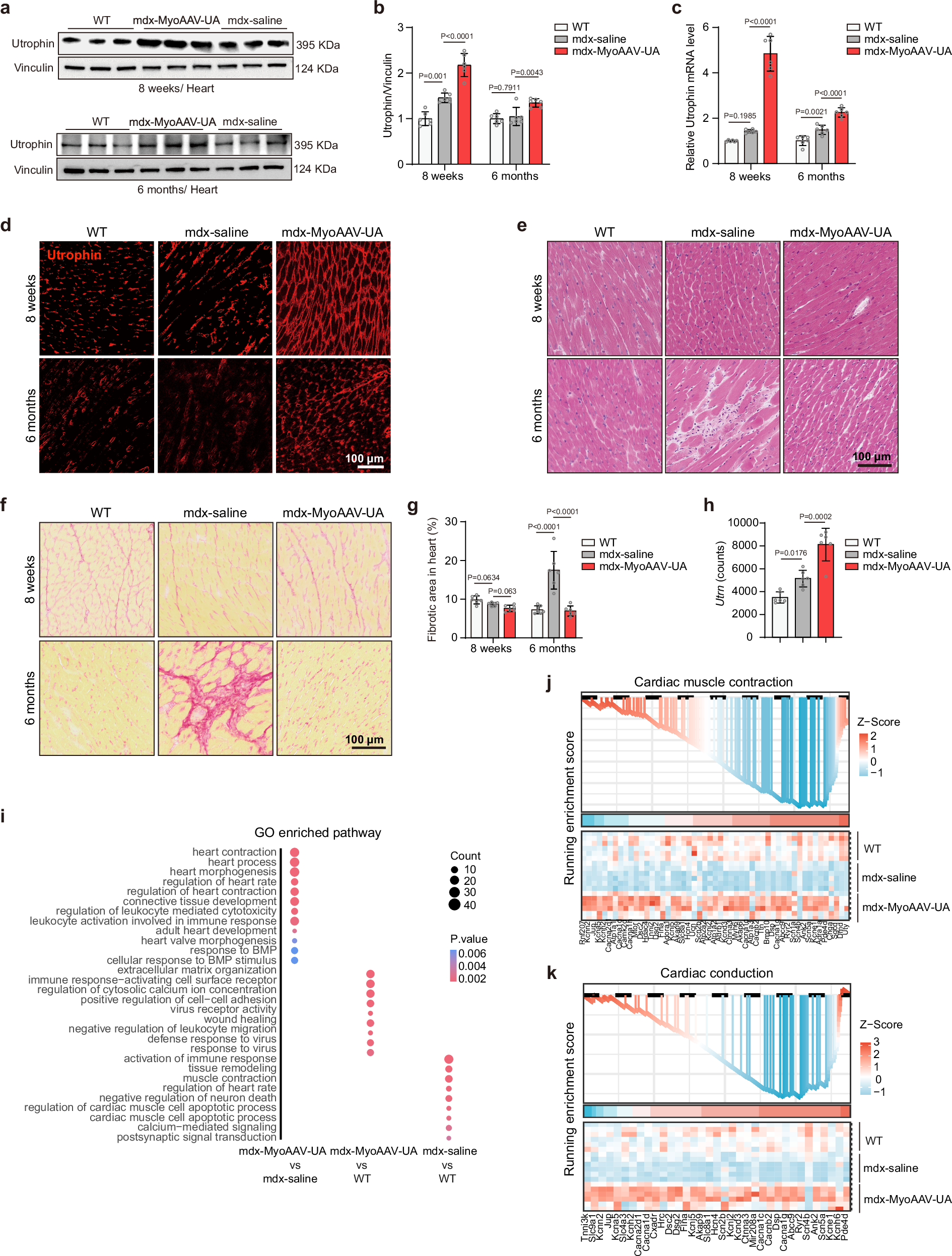 Fig. 3: Upregulation of utrophin through MyoAAV-UA improves cardiac pathology in mdx mice.