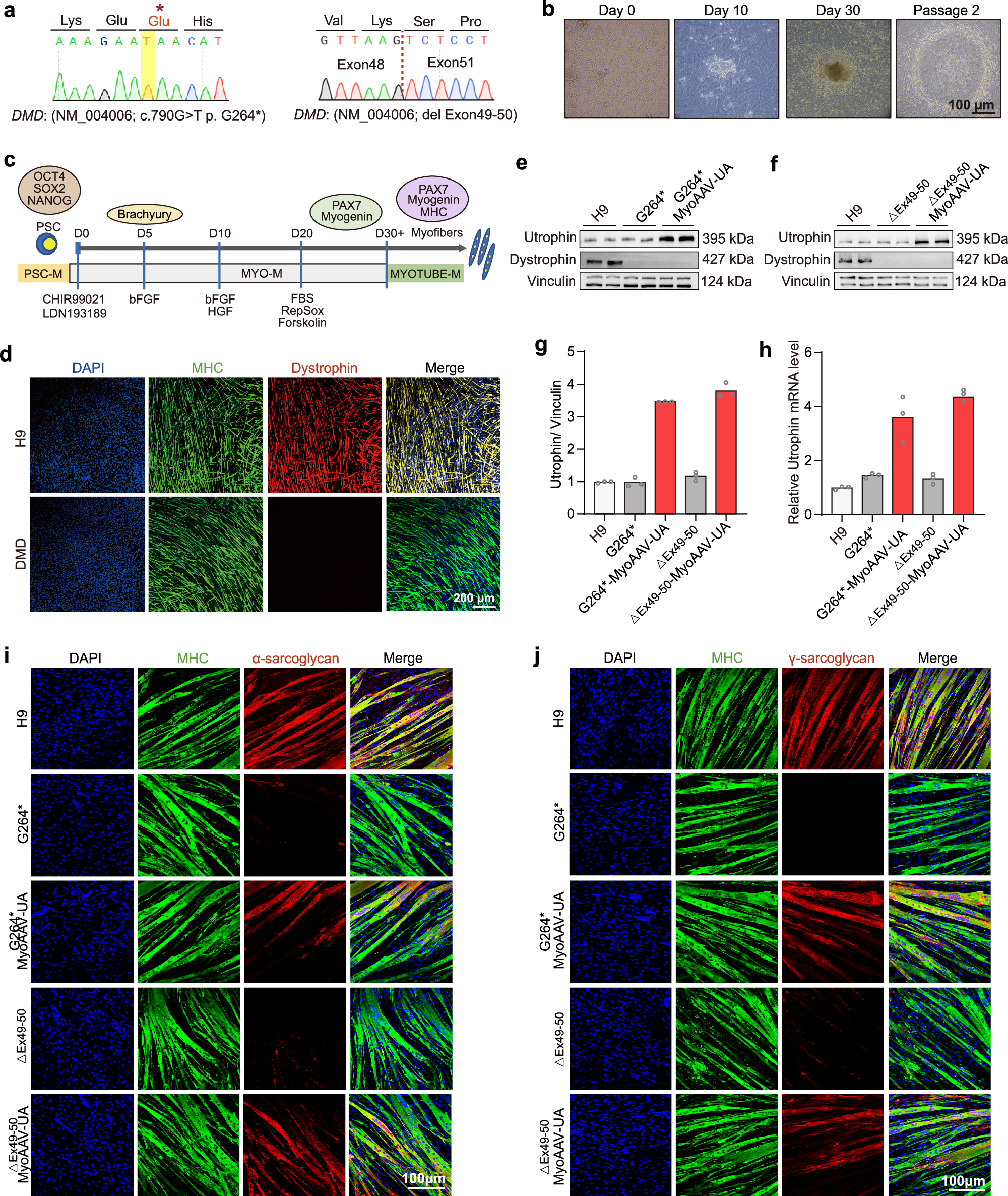 Fig. 5: MyoAAV-UA activates utrophin and increases sarcoglycan expression in differentiated myotubes derived from DMD patients.