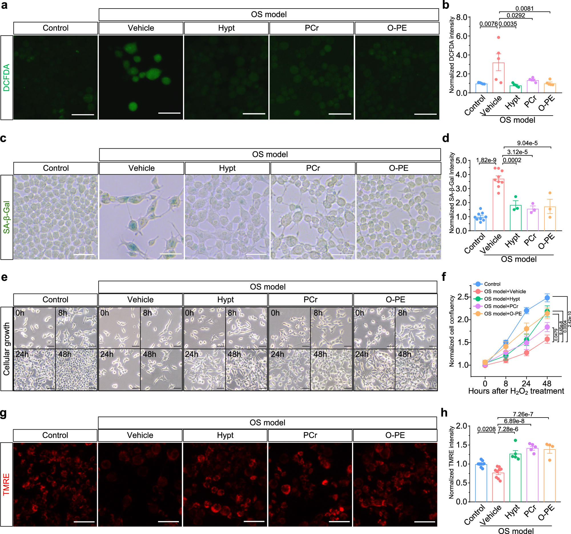 Fig. 7: Effects of key metabolites on OS and induced senescence.