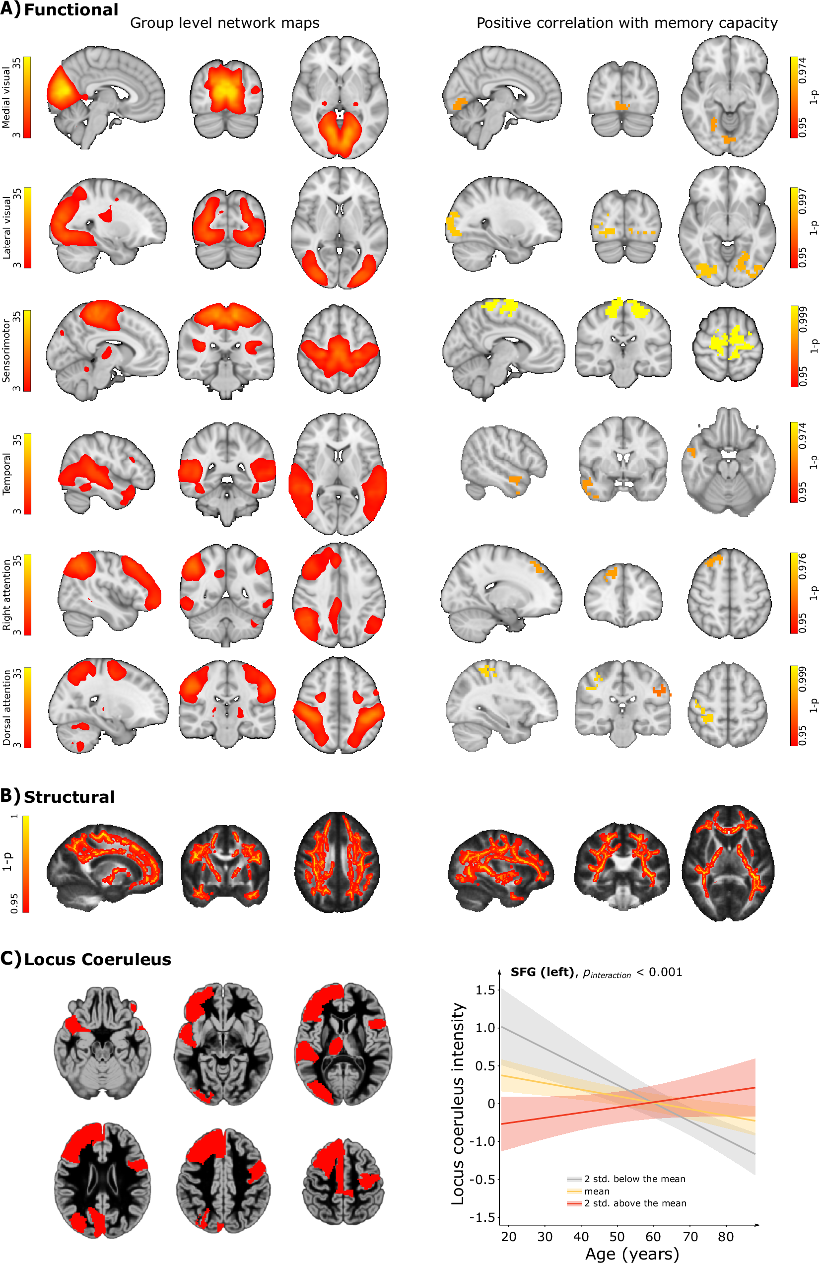 Fig. 2: Association of memory capacity with measures of structural integrity, functional activation and locus coeruleus intensity.