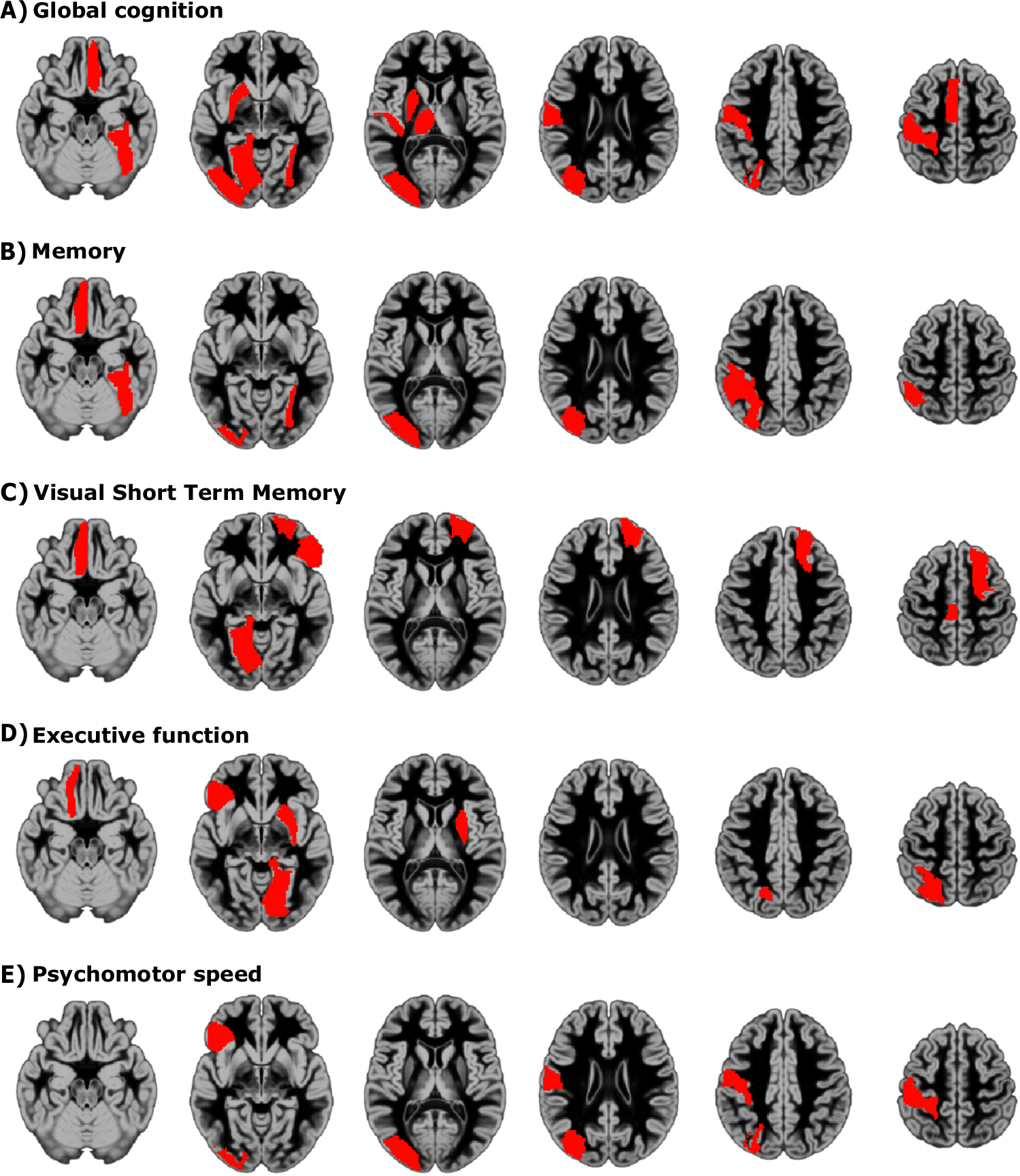Fig. 3: Regional memory capacity and cognitive performanice.