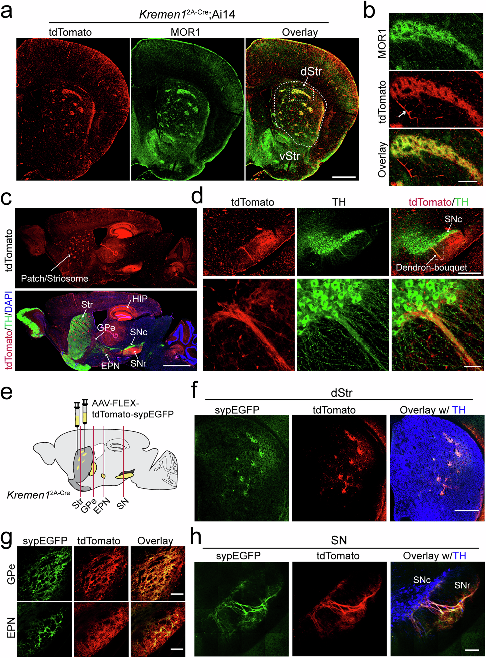 Fig. 2: Distinct distribution patterns of Kremen1+ SPNs in the dorsal striatum and their projections.