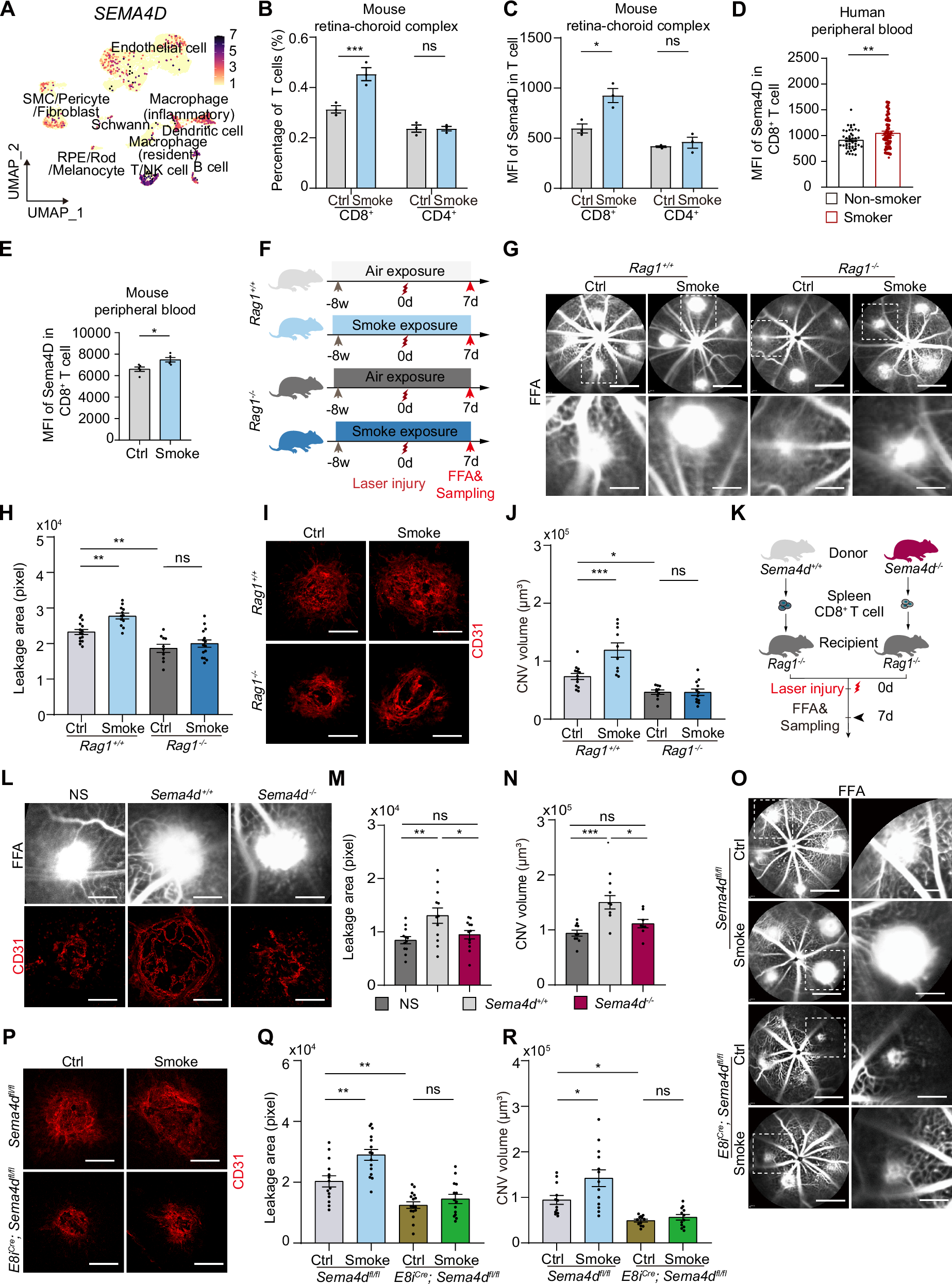 Fig. 2: Sema4D in CD8+ T Cells Aggravates Smoking-Induced CNV.