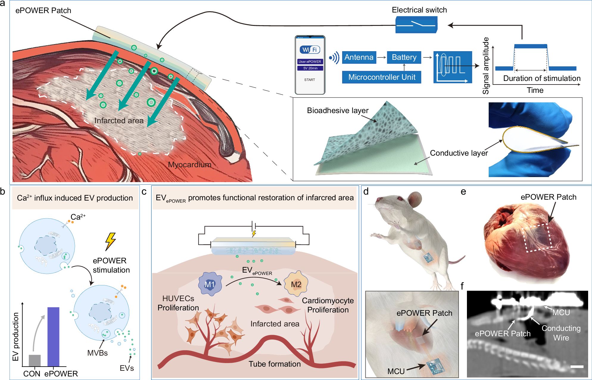 Fig. 1: Schematic of implantable, flexible bioelectronics for MI treatment.
