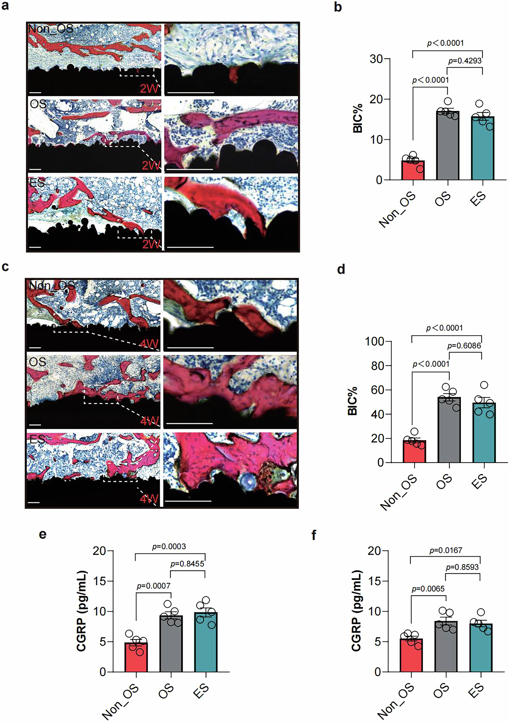 Fig. 6: OS of Piezo2+ mechanical nociception promotes implant osseointegration.