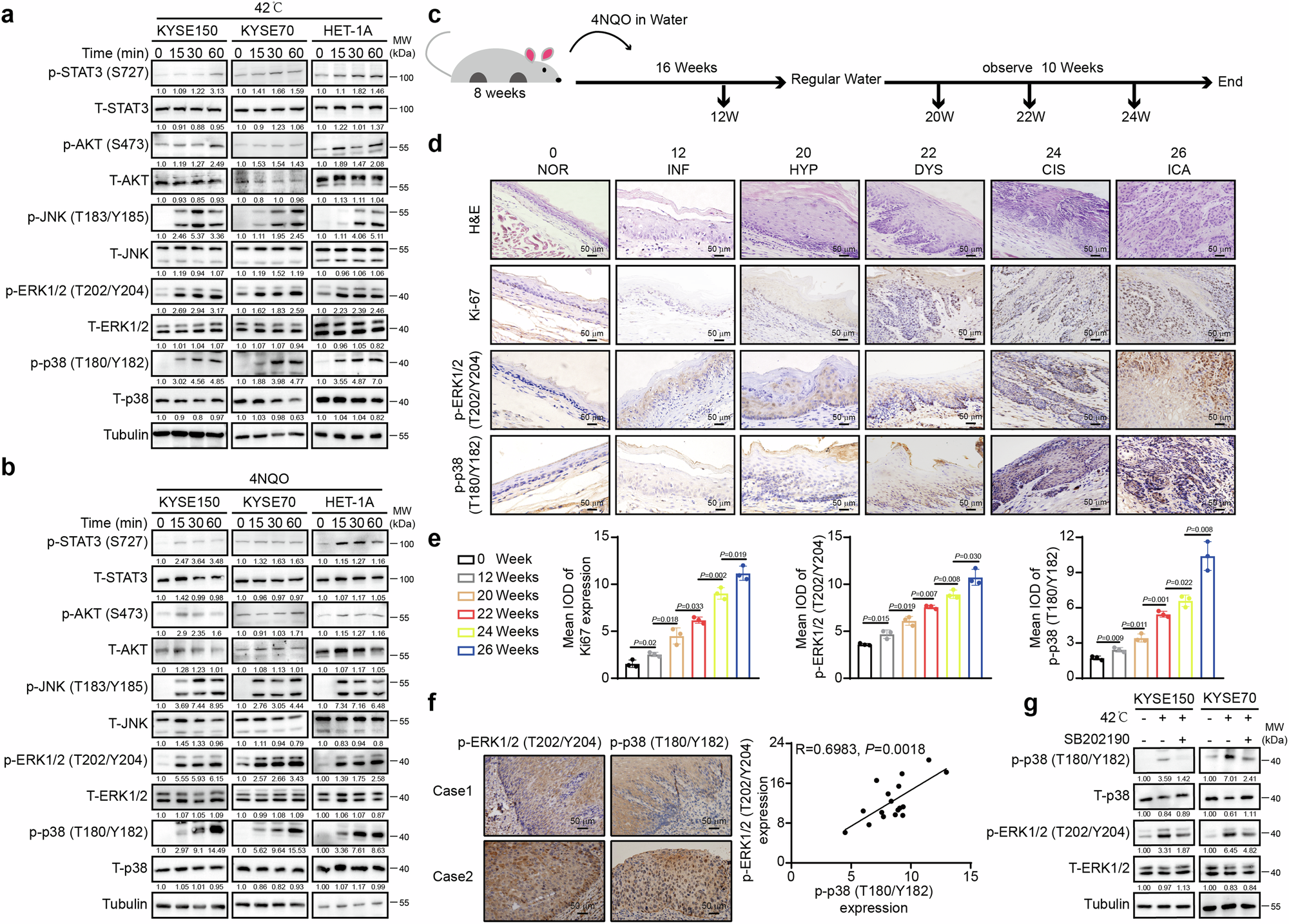 Fig. 1: Signaling pathways investigation and p-p38 and p-ERK1/2 correlation under stress stimulus in ESCC tumorigenesis procedure.