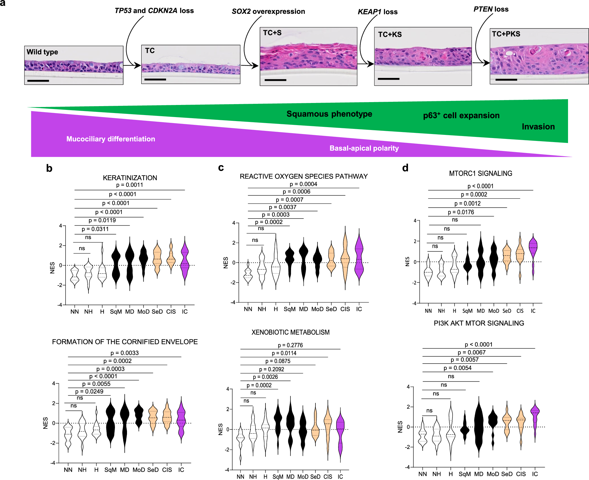 Fig. 7: A hypothetical evolutionary sequence of pathway activation in LUSC development.