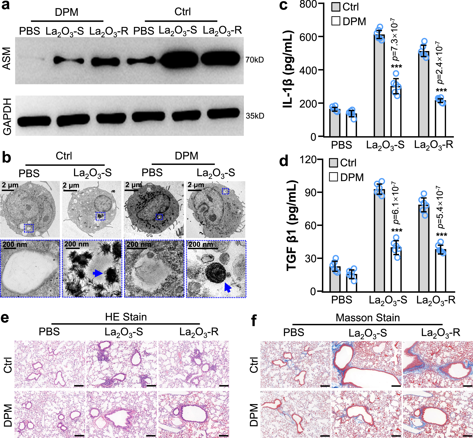 Fig. 5: Validation of SMPD1 regulation on the biotransformation and adverse effects of La2O3 in animal lungs.