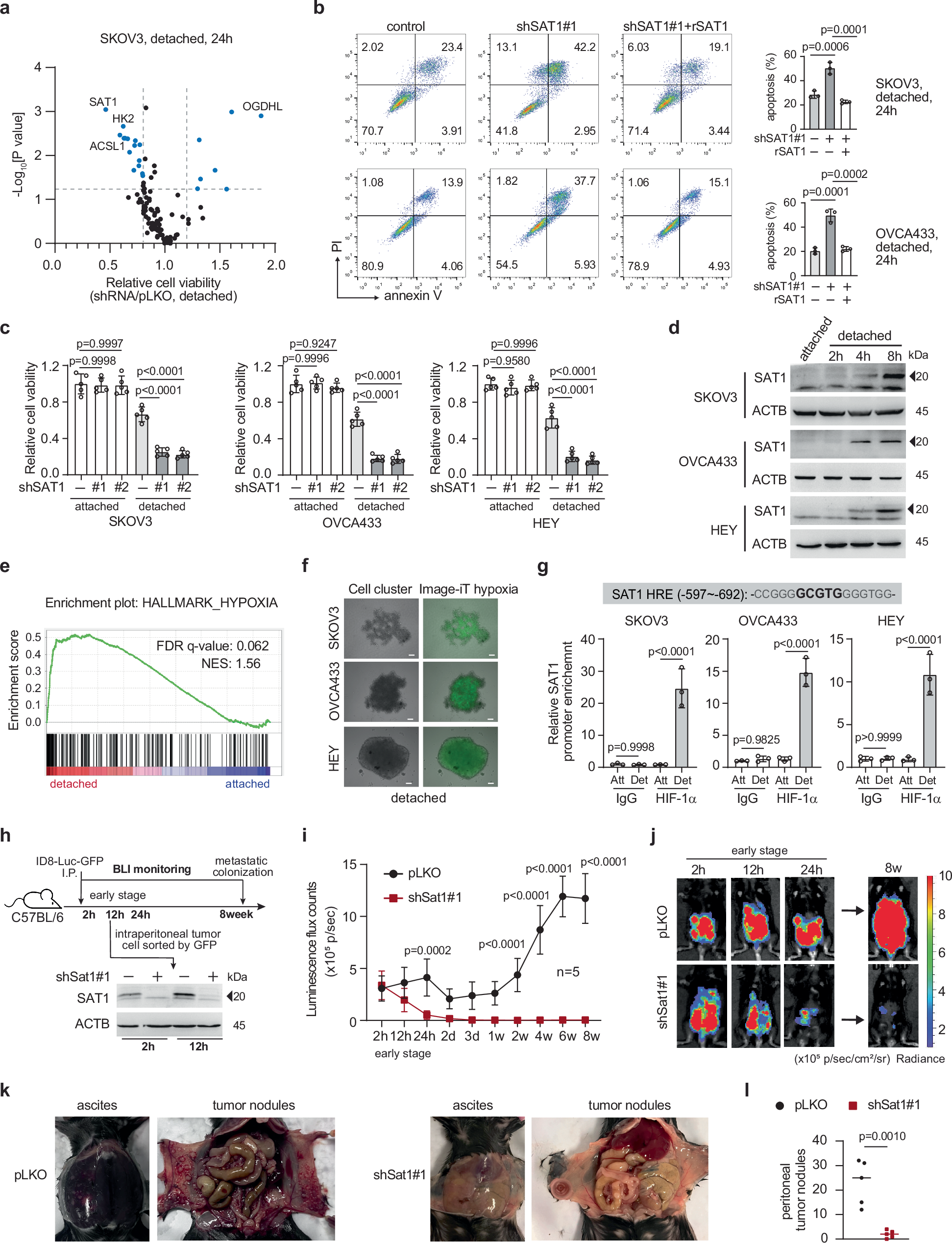 Fig. 1: SAT1 promoted anchorage-independent cell survival and peritoneal metastasis.