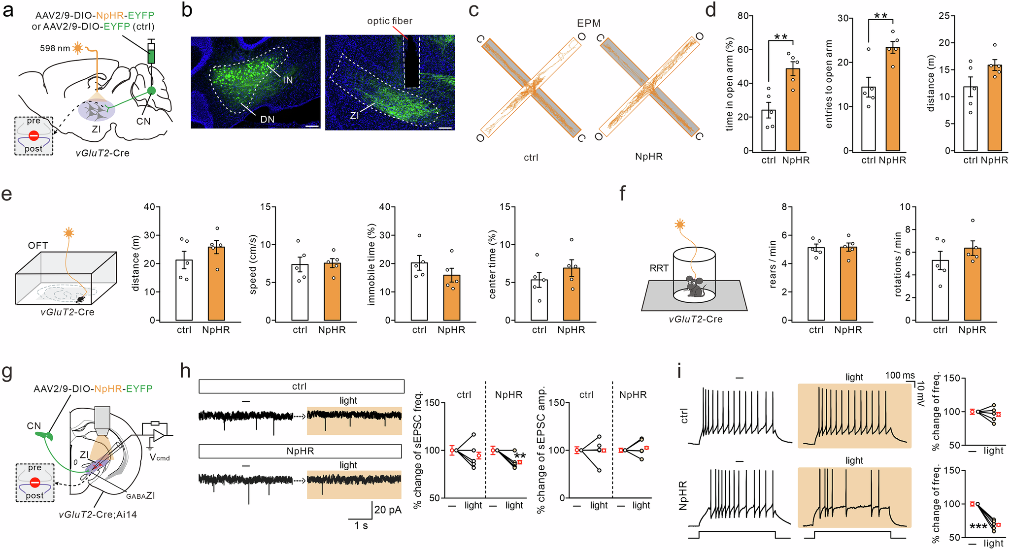Fig. 5: Photoinhibition of CNGLU → ZI circuit reduces anxiety.