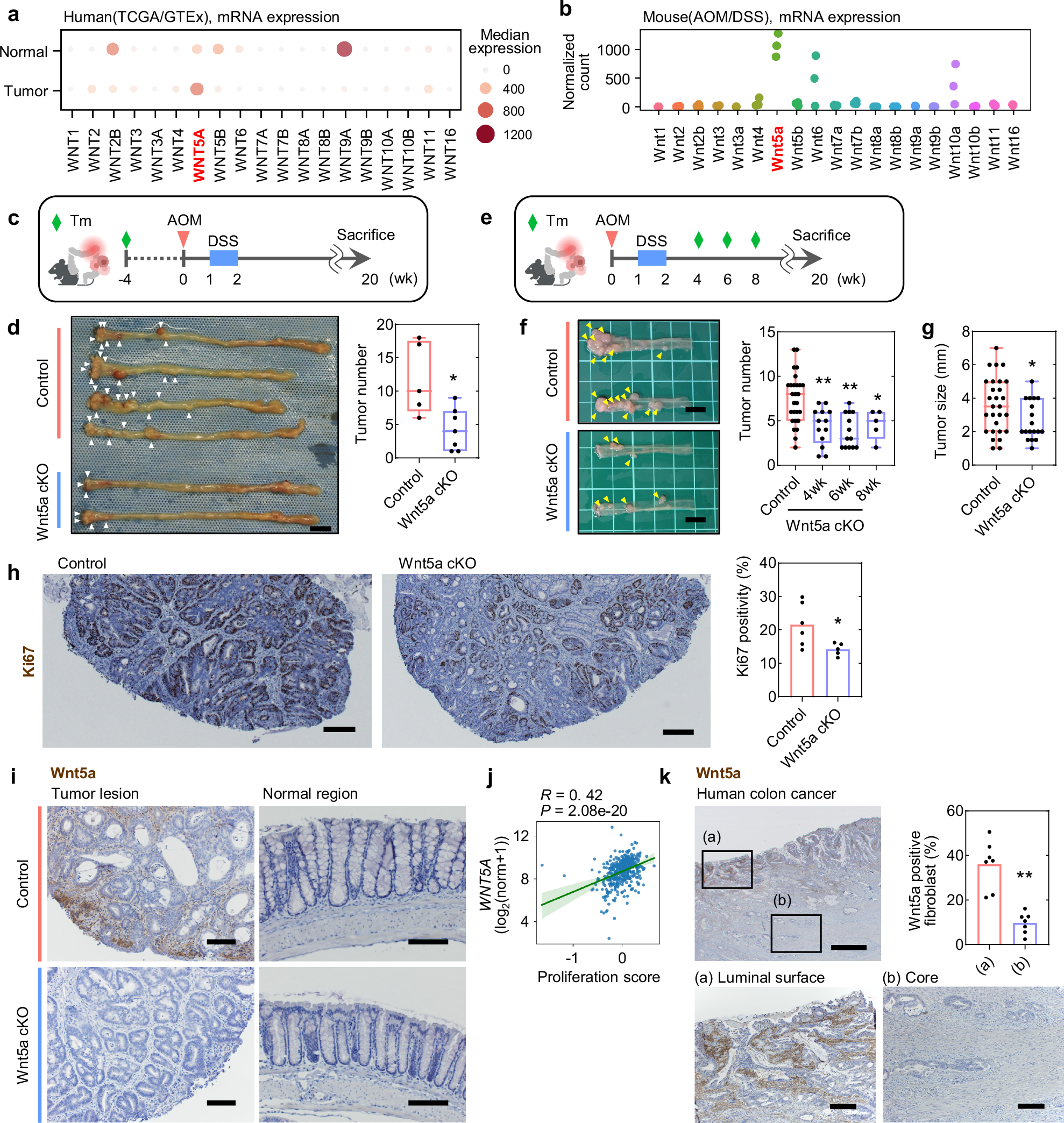 Hypoxia-induced Wnt5a-secreting fibroblasts promote colon cancer  progression | Nature Communications