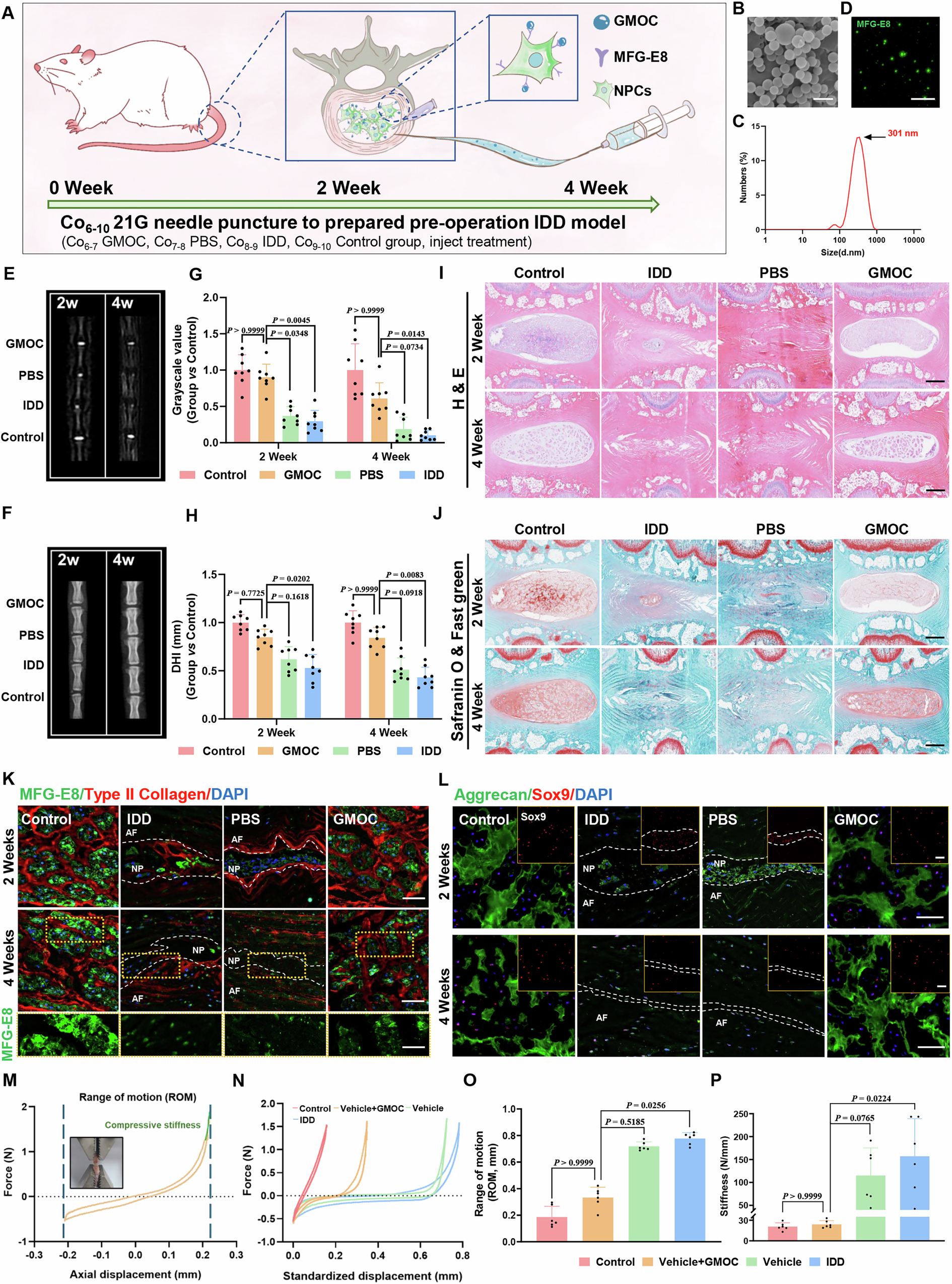 Fig. 6: Assessment of the therapeutic effect of GMOC in a pre-operation IDD model in rats.