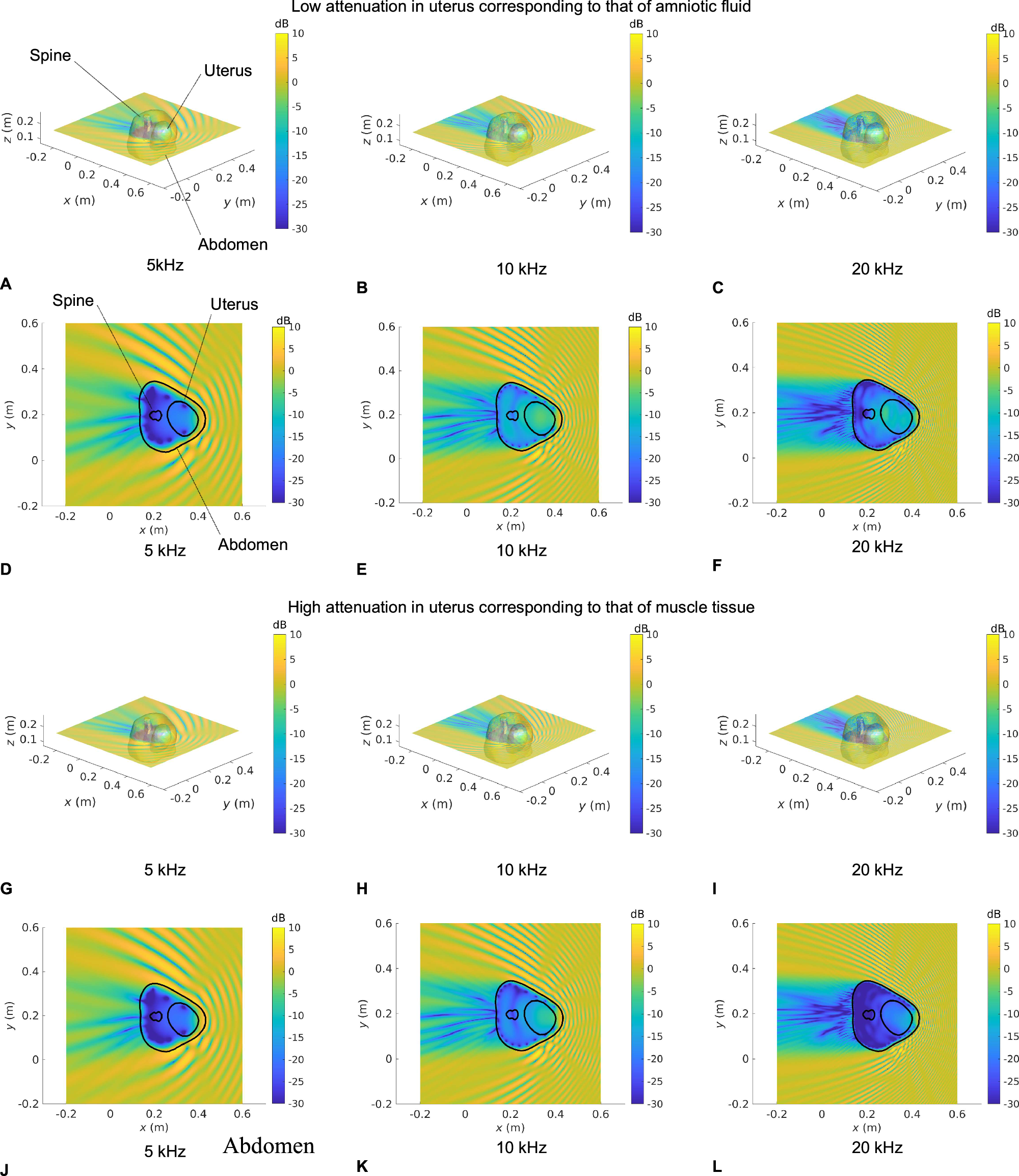 Fig. 3: Sound pressure level maps at 5, 10, and 20 kHz for Subject 1 for an incident unit amplitude plane wave.