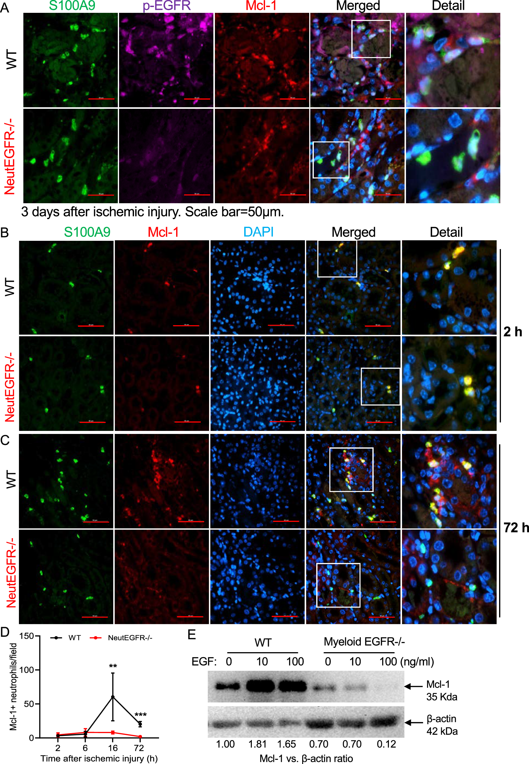 Fig. 8: EGFR signaling promoted renal neutrophil survival via maintaining antiapoptotic protein Mcl-1 levels after ischemic injury.