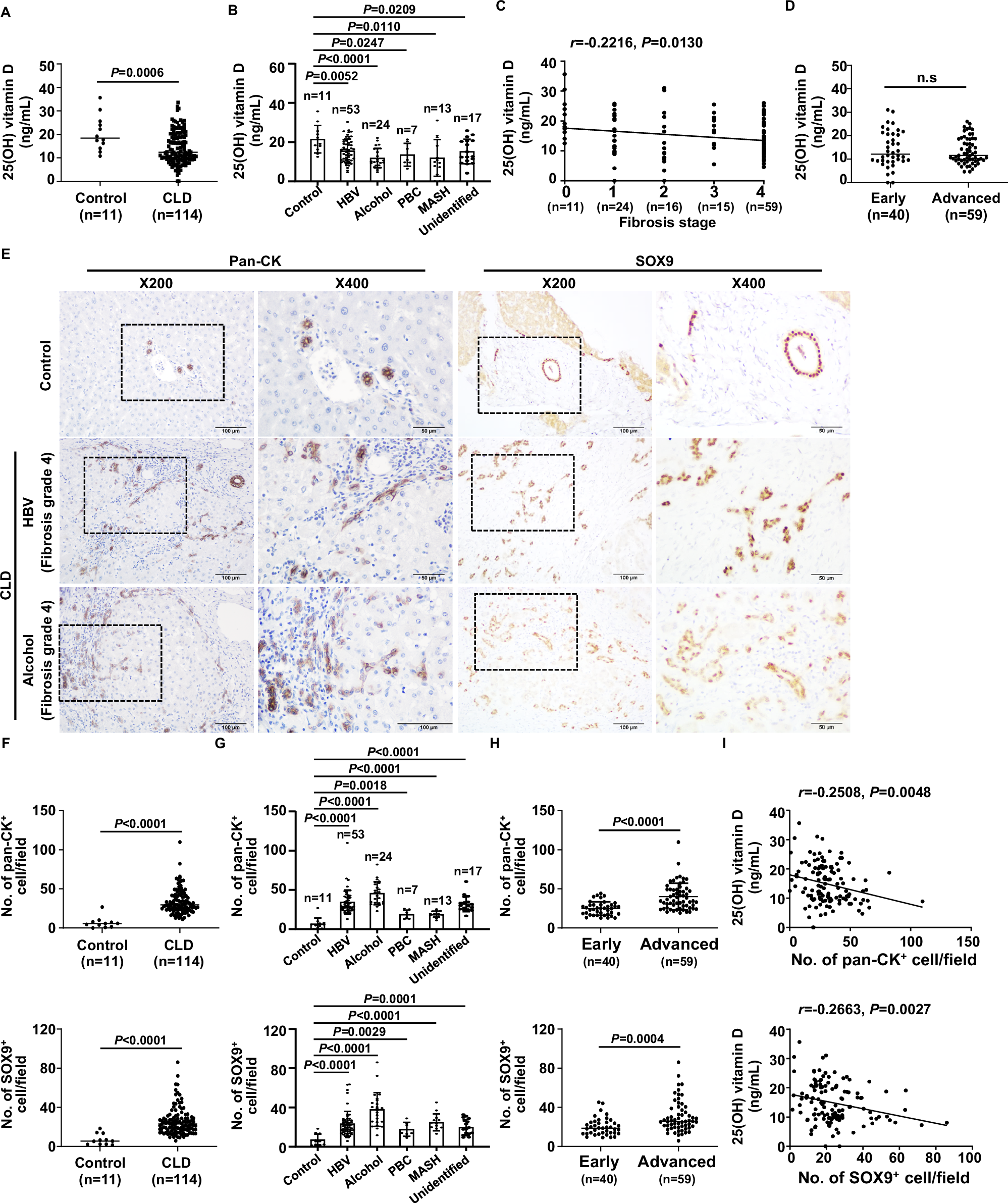 Fig. 1: Vitamin D levels are decreased in CLDs and negatively correlated with the degree of ductular reaction.