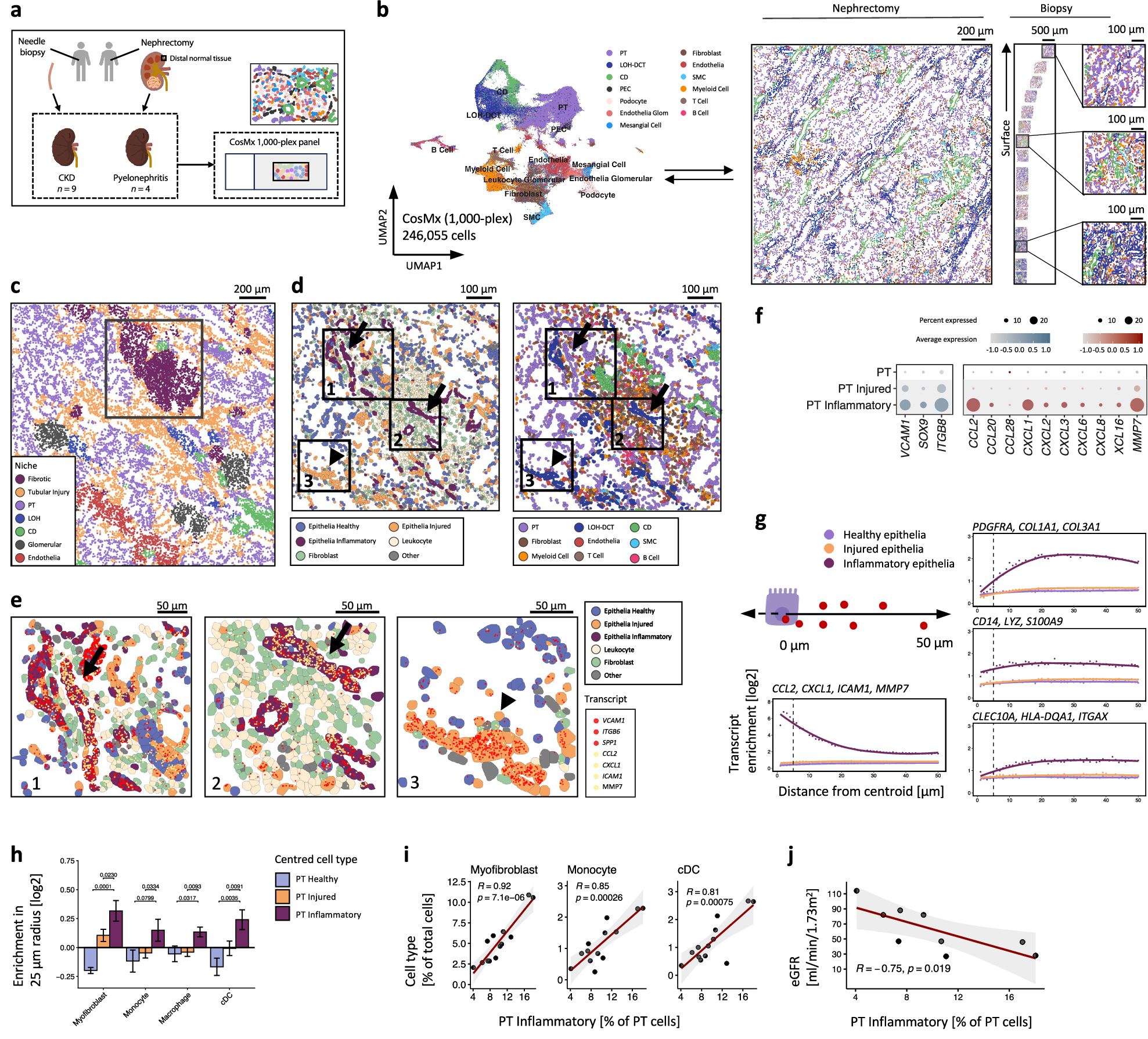 Fig. 4: Inflammatory cell states in the kidney across disease aetiologies.