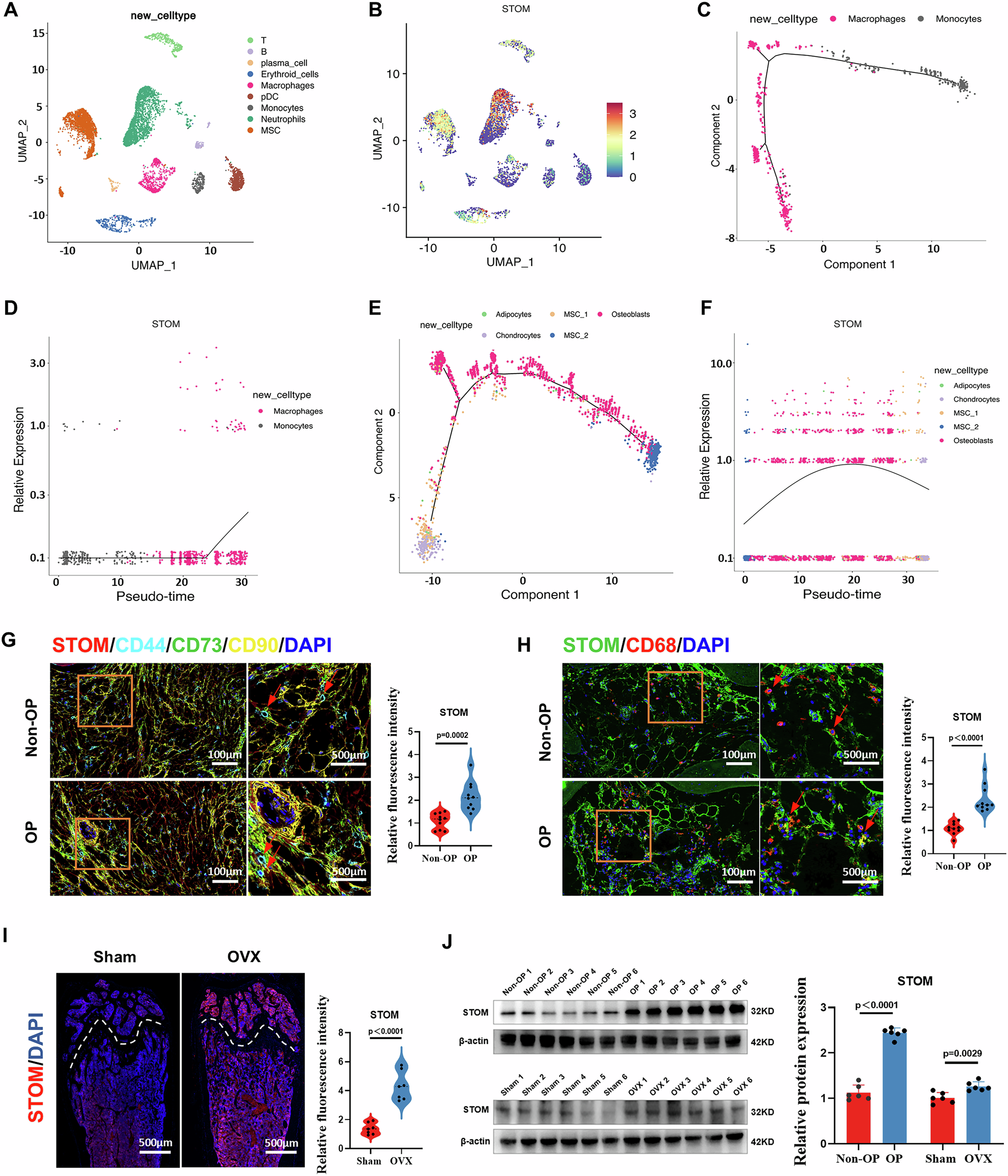 Fig. 1: STOM expression is elevated in OP patients and OVX mice.