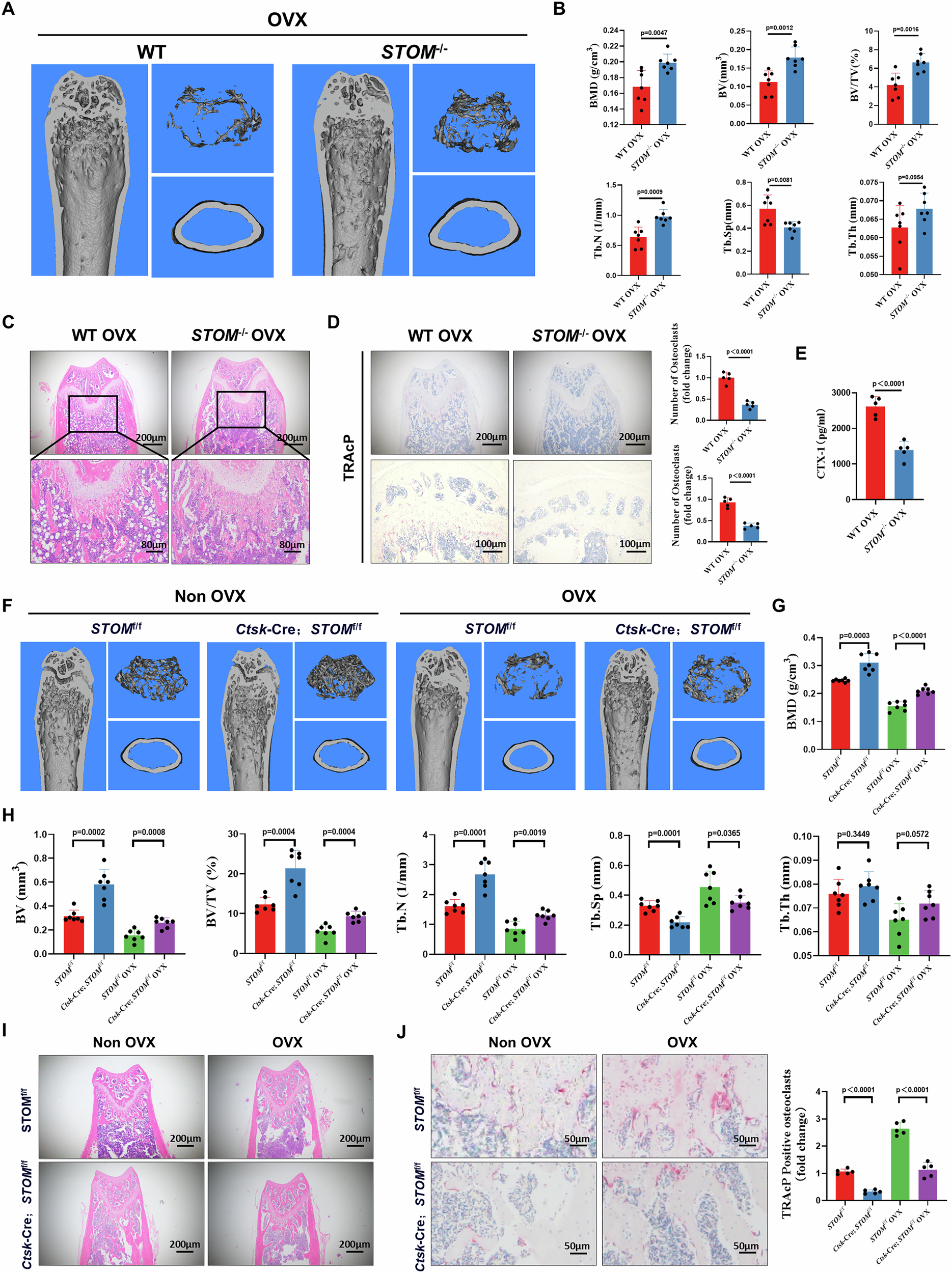 Fig. 3: Systemic and osteoclast-specific knockout of STOM both mitigate OVX-induced bone loss though inhibiting osteoclasts.