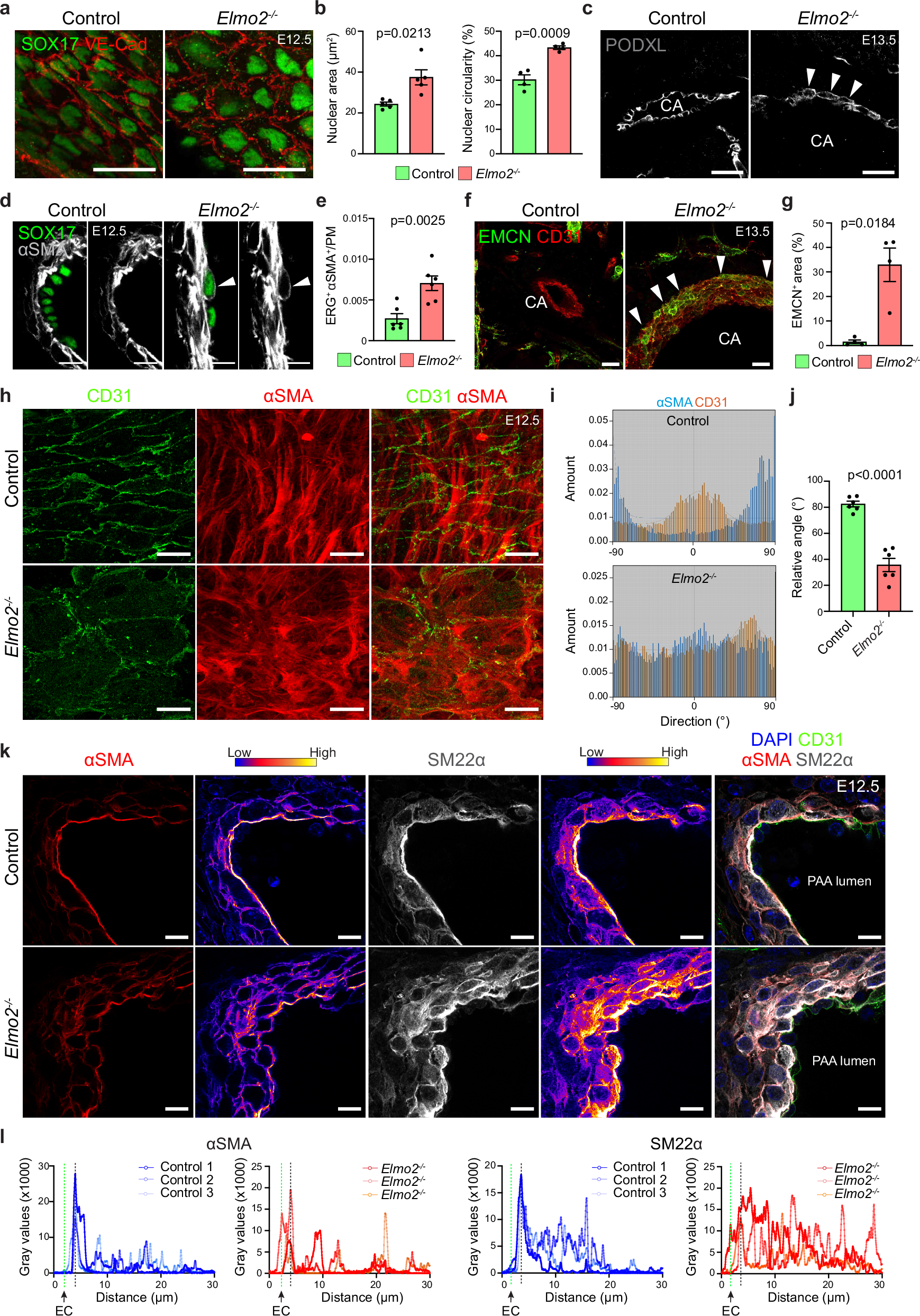 Fig. 2: Loss of Elmo2 causes defects in the third pharyngeal arch (3rd PAA) and carotid arteries (CAs).
