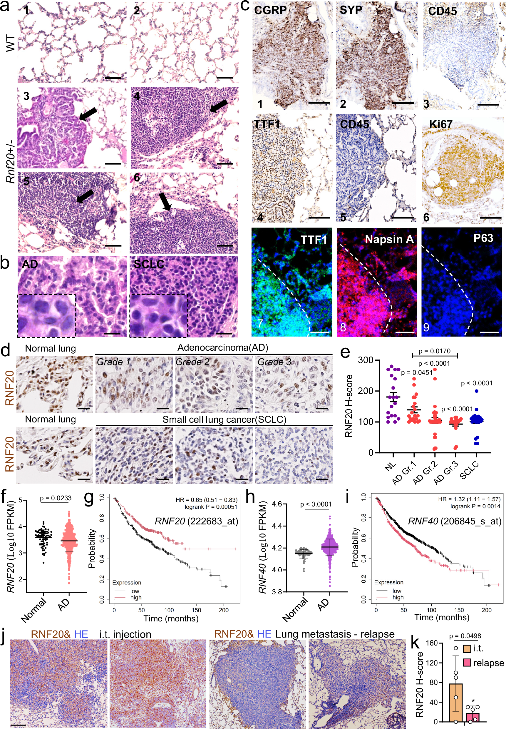 Fig. 1: Spontaneous lung tumor formation in Rnf20 + /- mice.