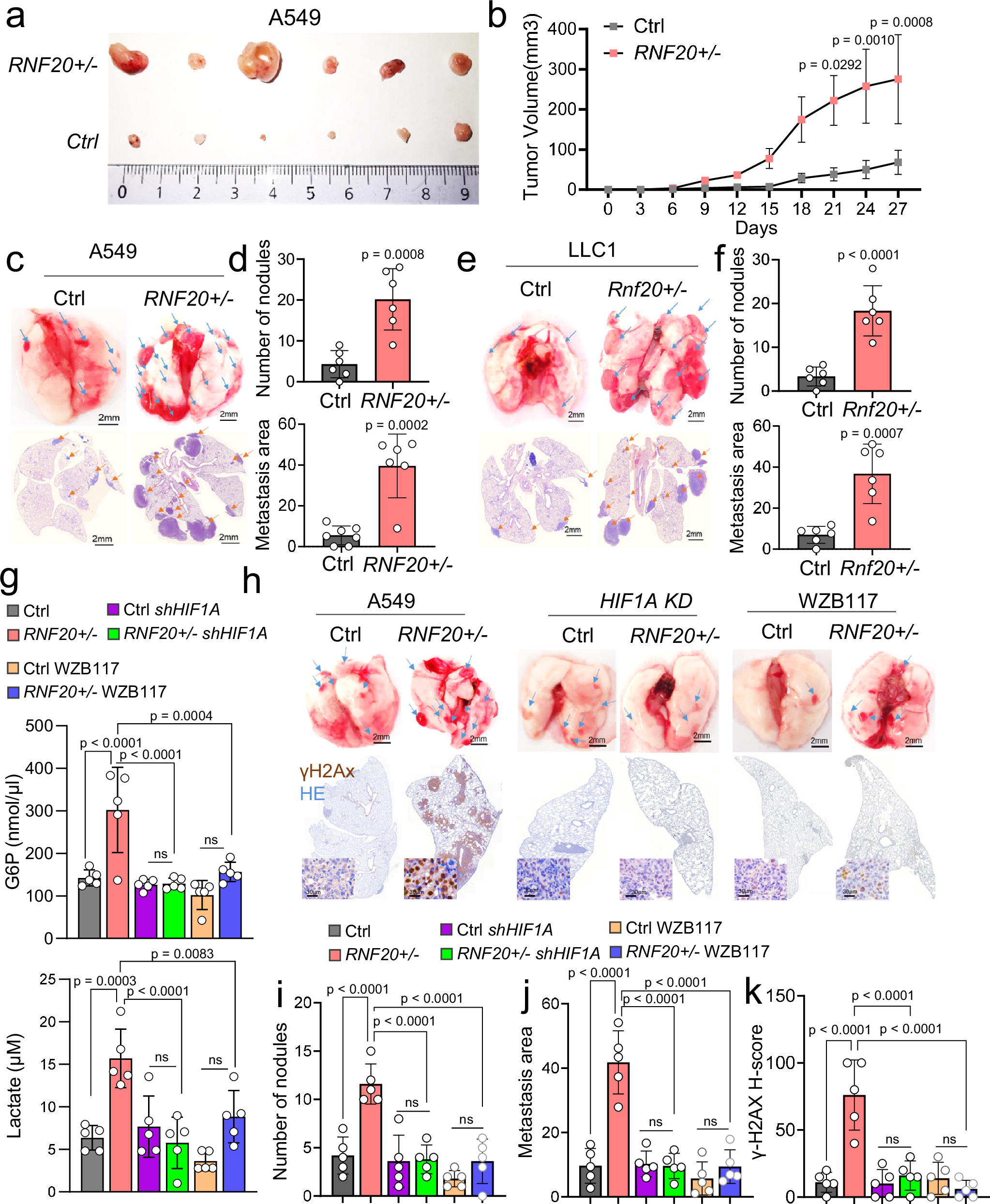 Fig. 7: RNF20 loss promotes tumor growth and metastasis through HIF1α activation and metabolic rewiring.