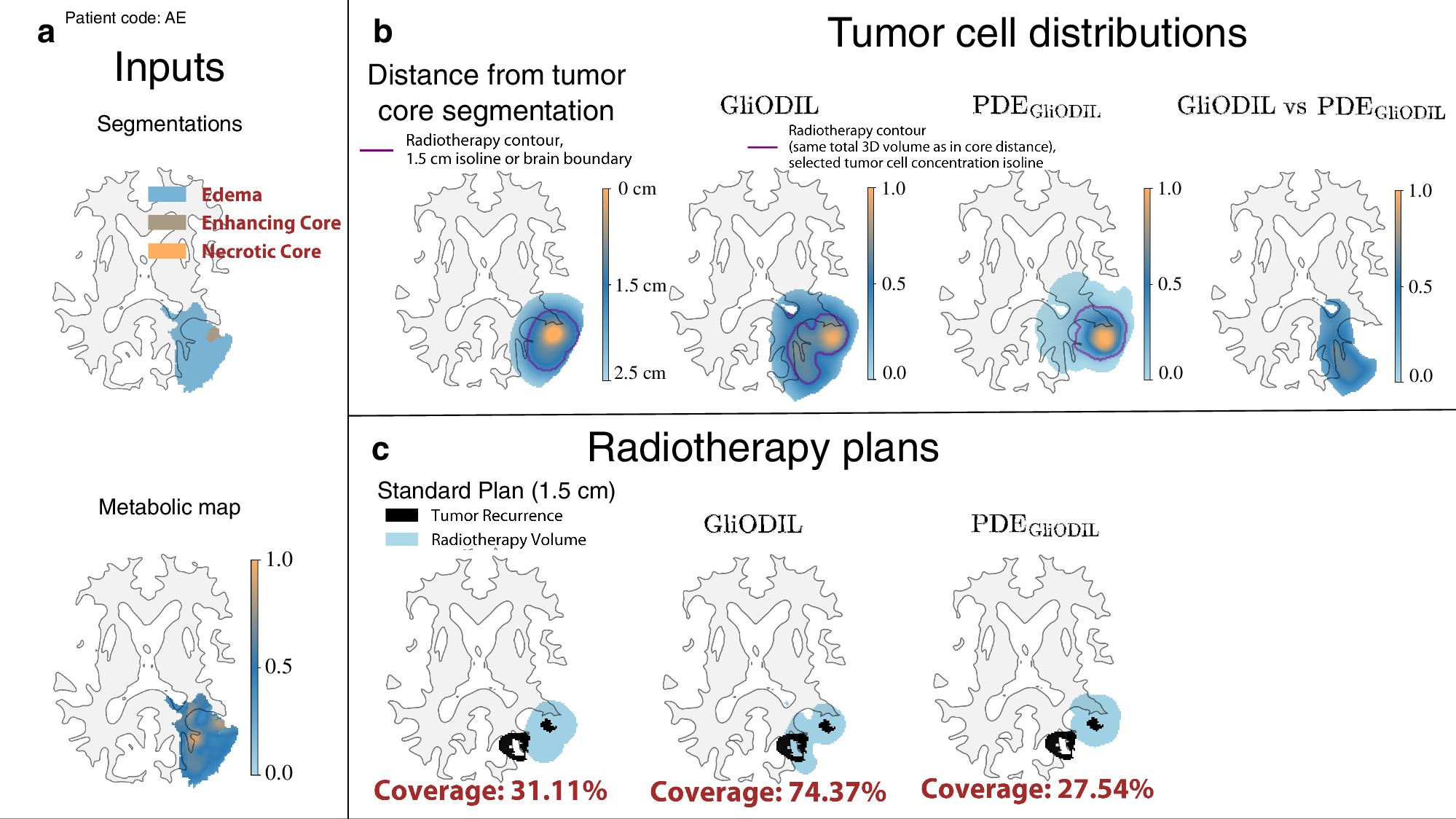Fig. 4: Illustration of radiotherapy planning: uniform distance margin (Standard Plan) vs GliODIL vs. PDE solution.