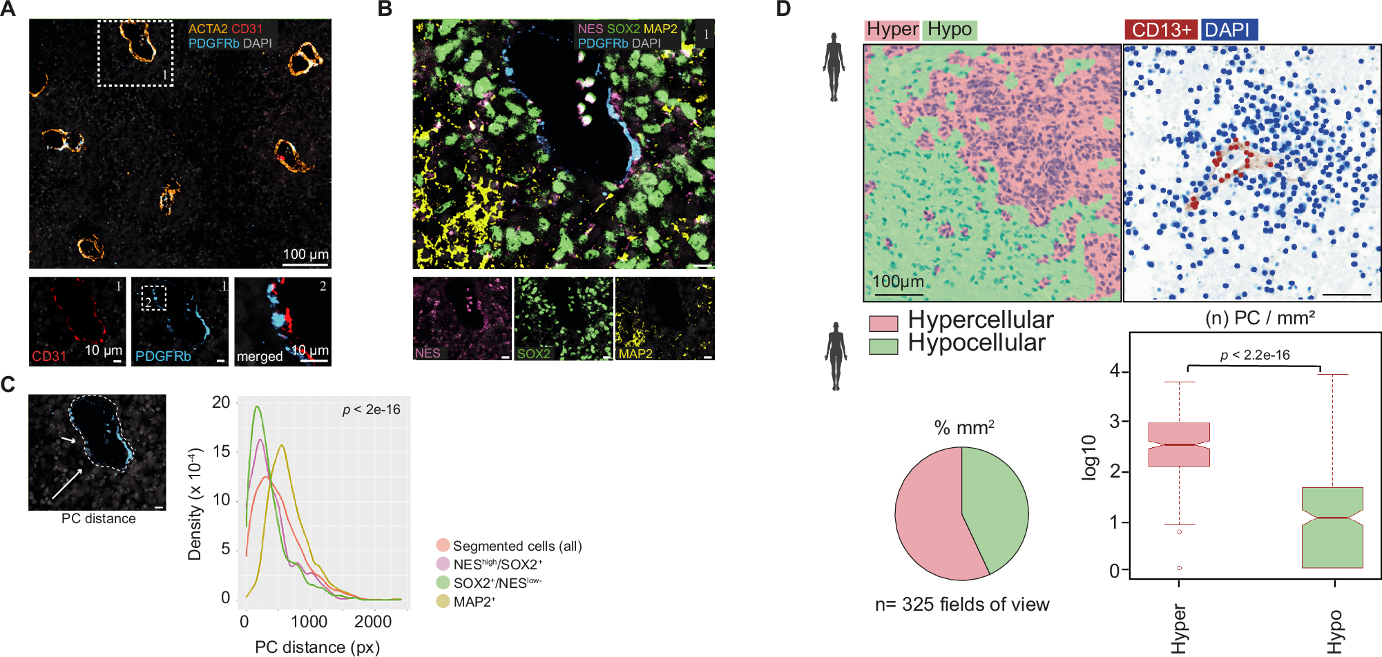 Fig. 3: PCs are enriched in ETMR hypercellular regions, which correlate with stem-like cell fates.